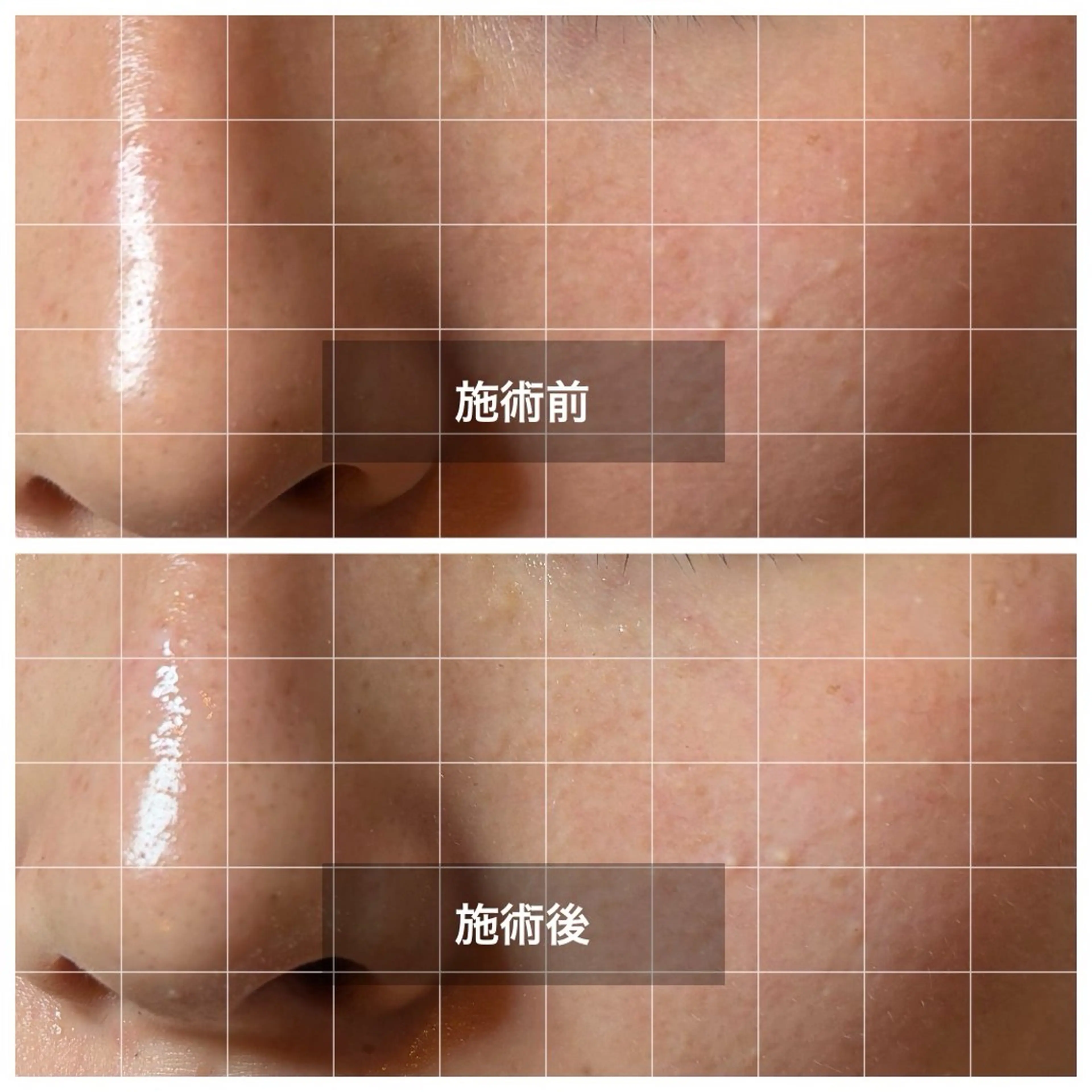 AI belleのエステ・リラクイメージ