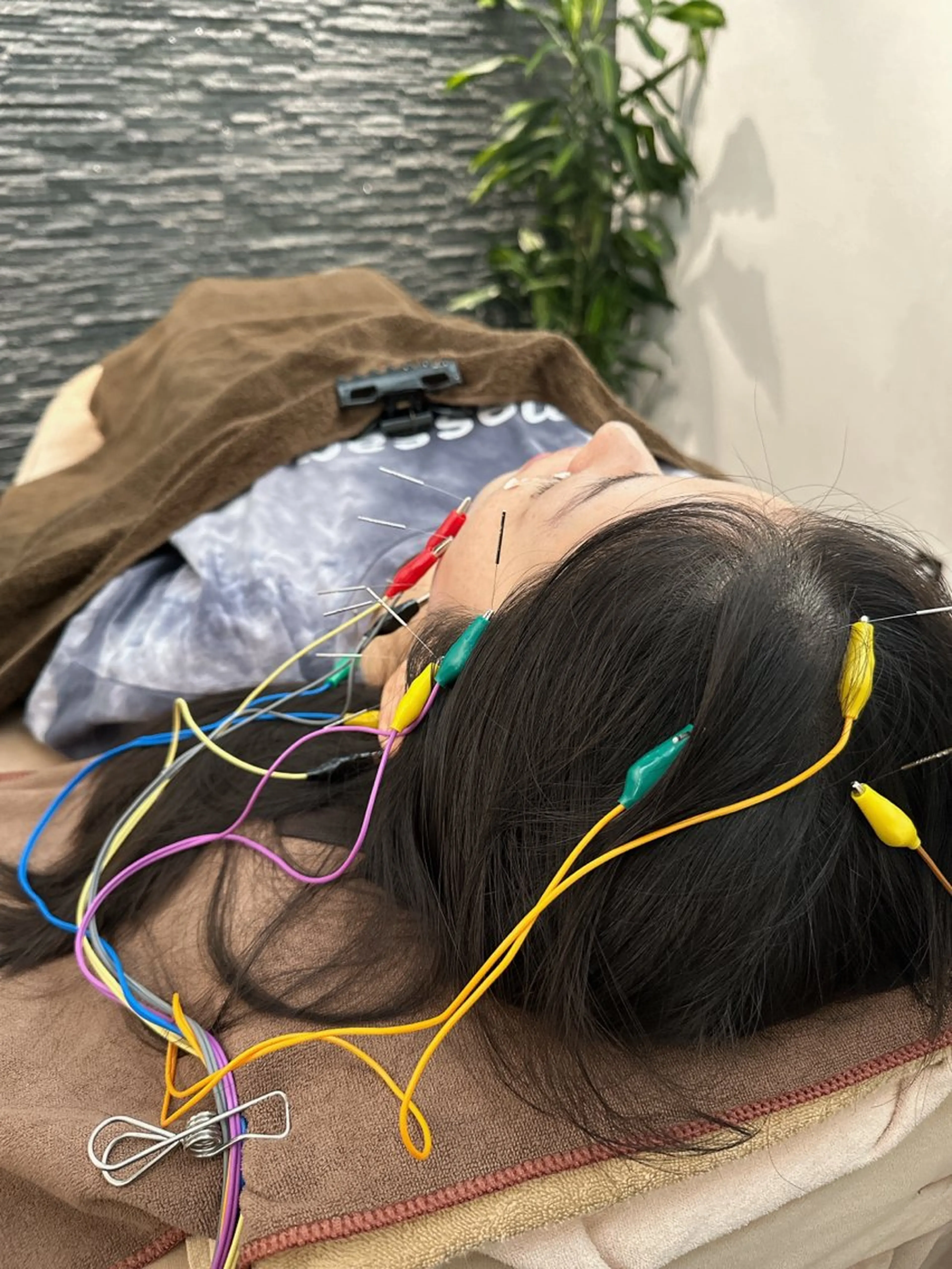 その他 美容鍼灸整体サロンBeauJu所属・小顔矯/美容鍼/鍼灸 BeauJuのその他イメージ