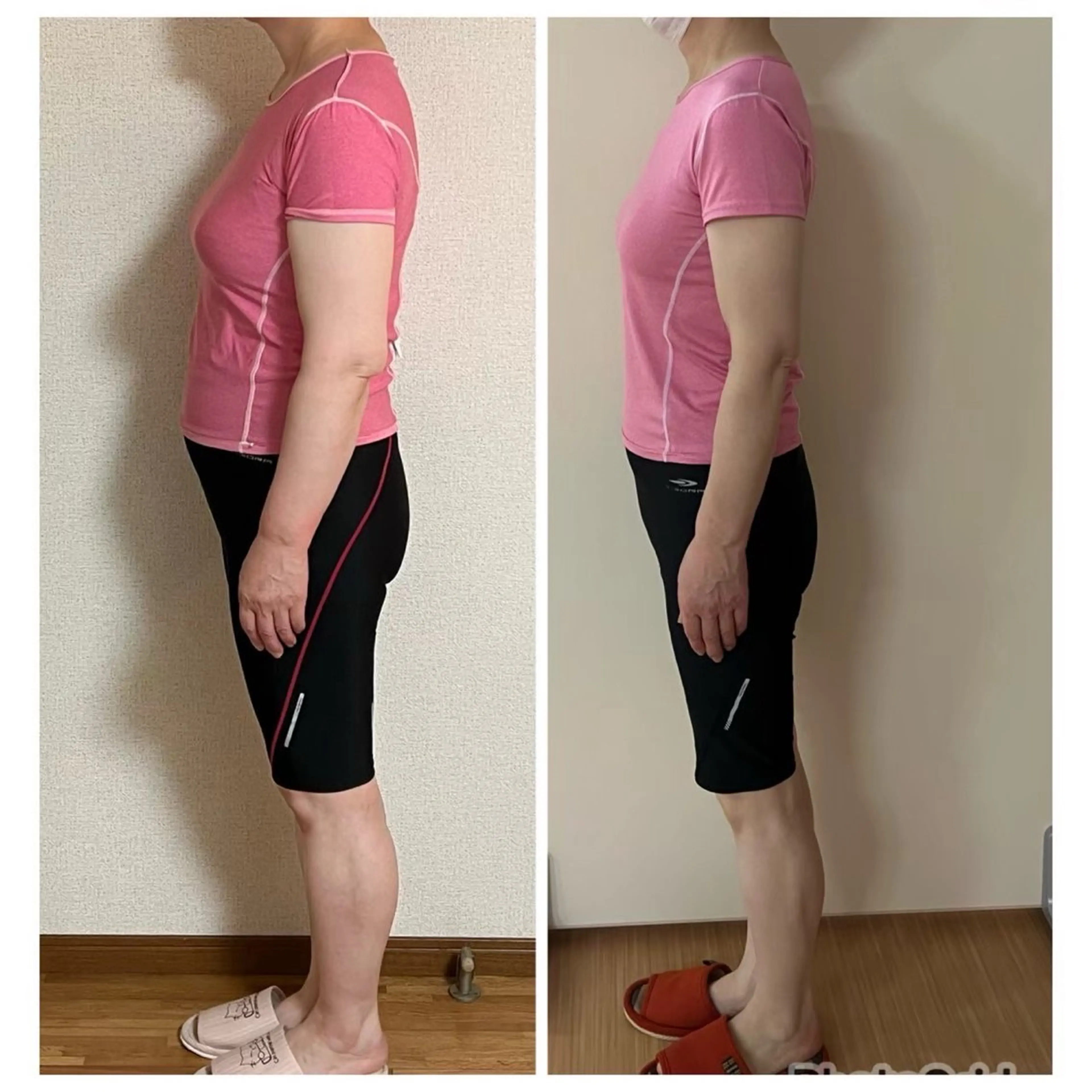 美人スイッチdiet スーパージェクションのその他イメージ