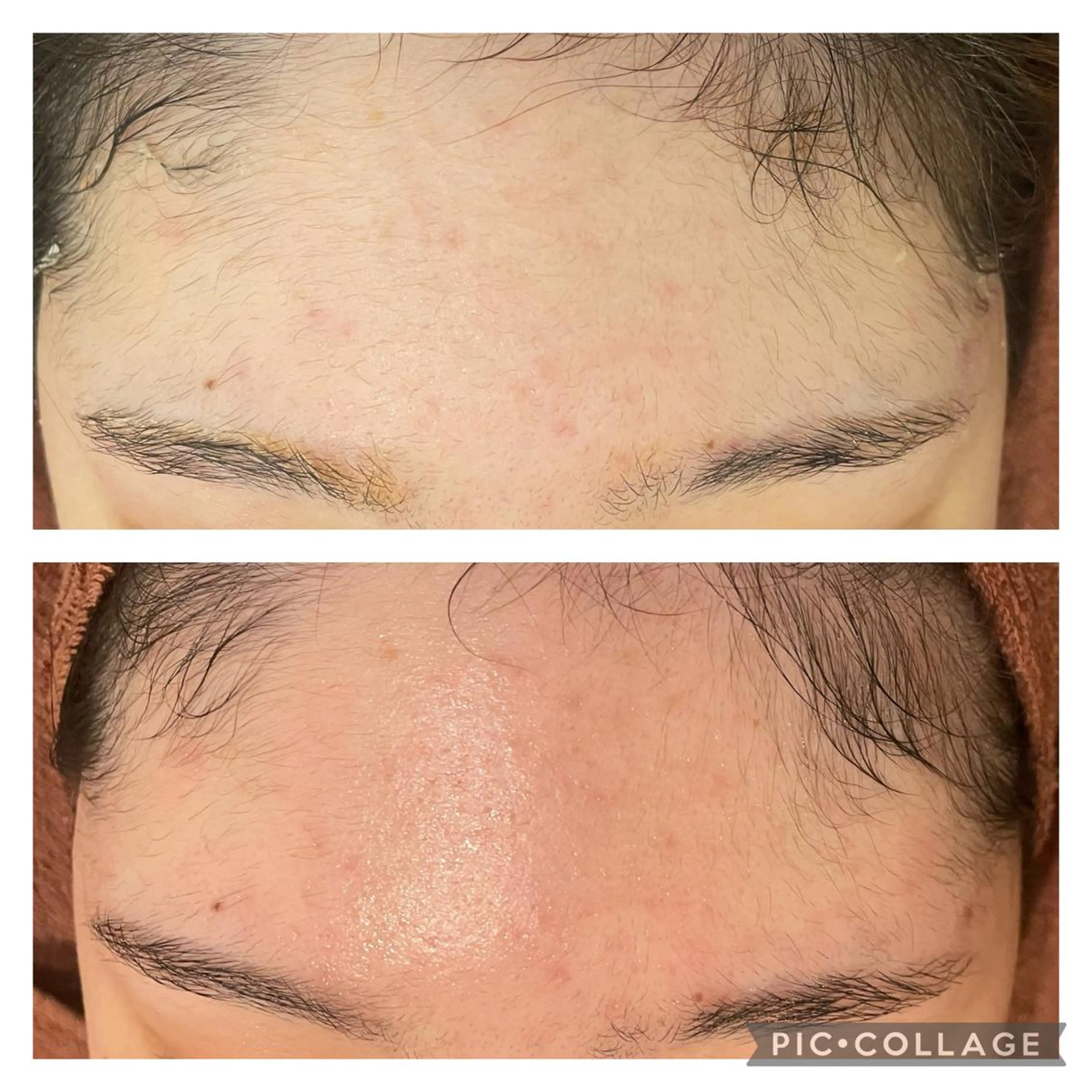 ロング カラー パーマ ヘアアレンジ メンズ キッズ ネイル マツエク・マツパ アイブロウ ニキビ特化型エステ 🍋最短で肌質改善のエステ・リラクイメージ