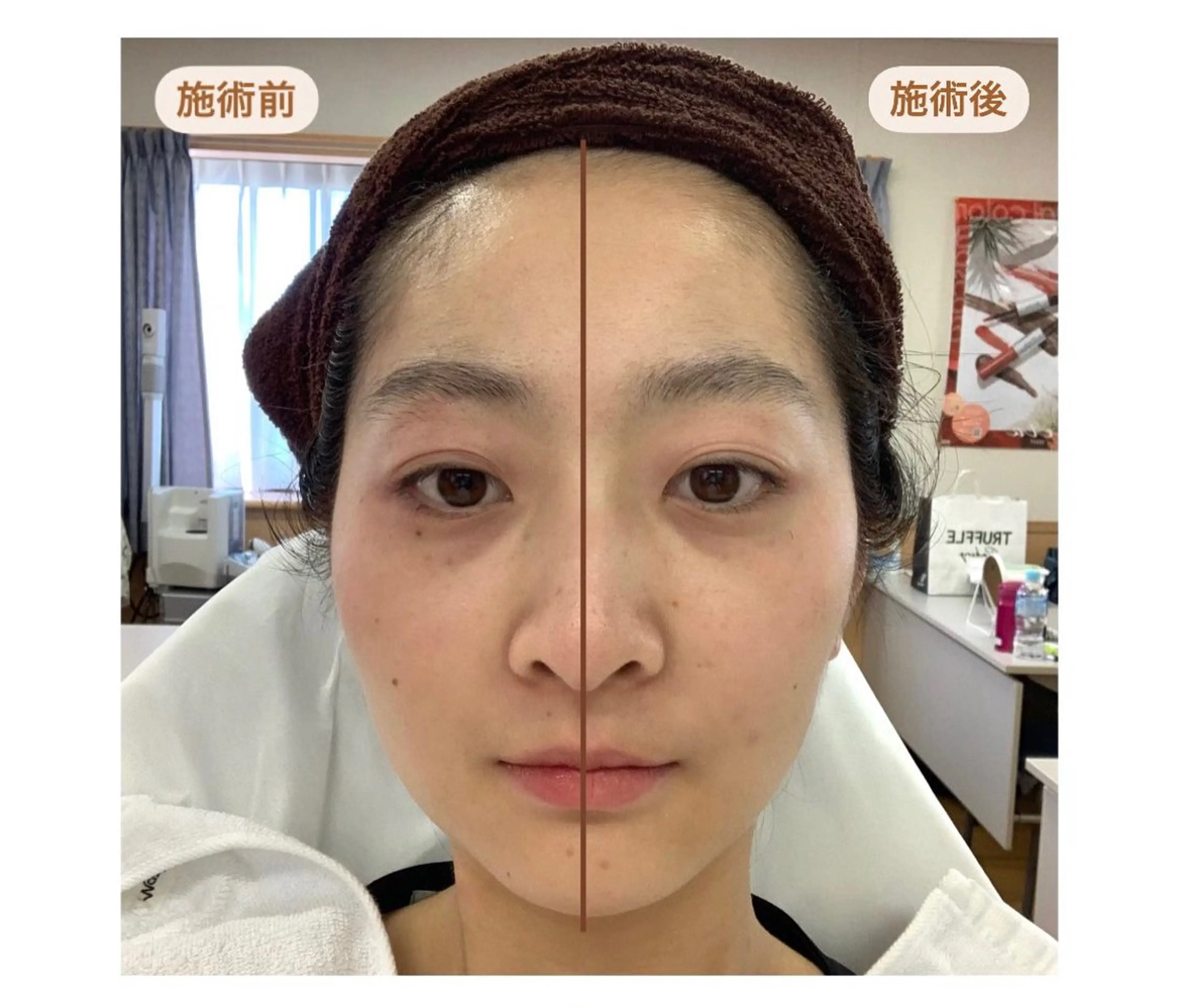 DeI’m我孫子店所属・碇(安原) 菜々子のエステ・リラクイメージ