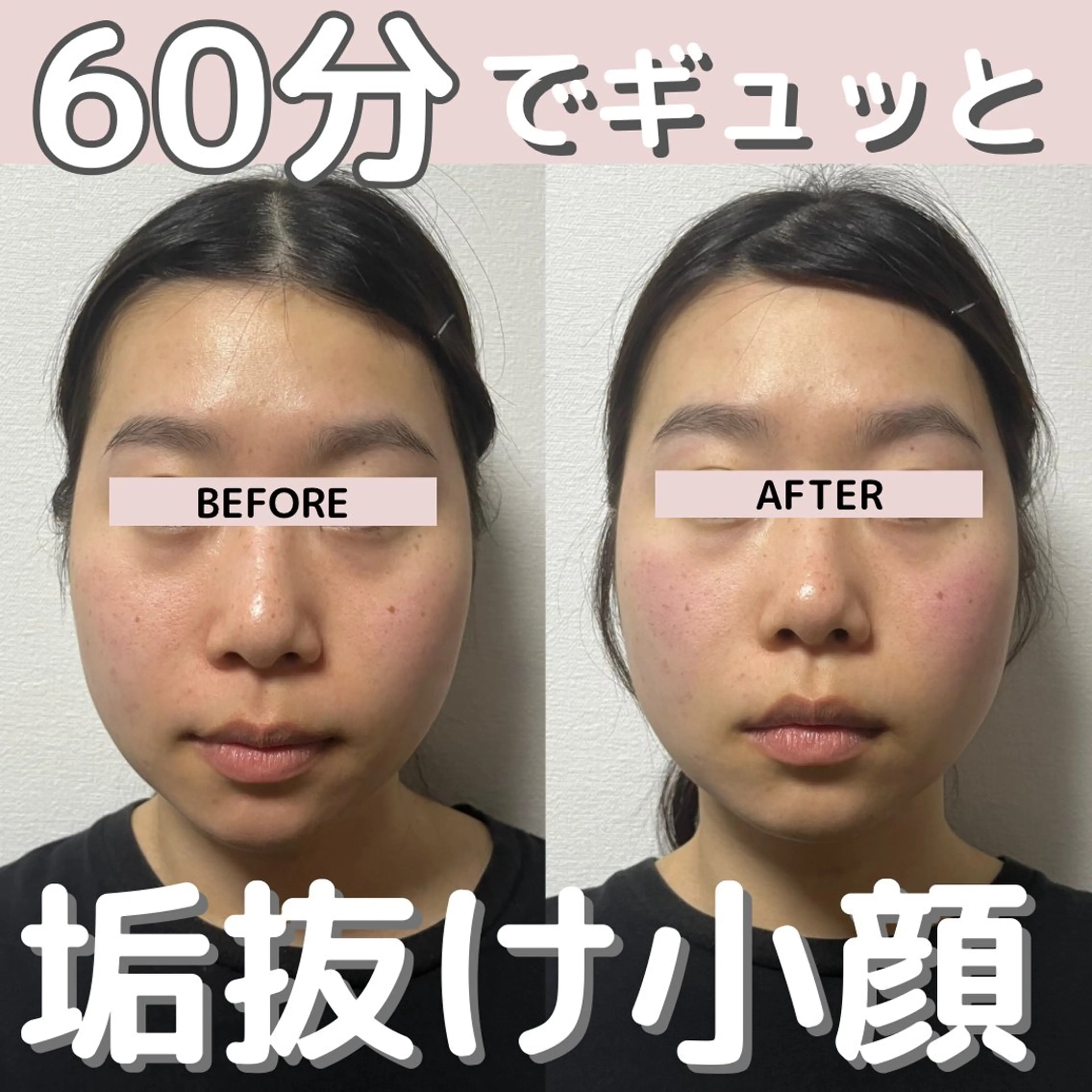 小顔矯正/骨格矯正 AKANEのエステ・リラクイメージ