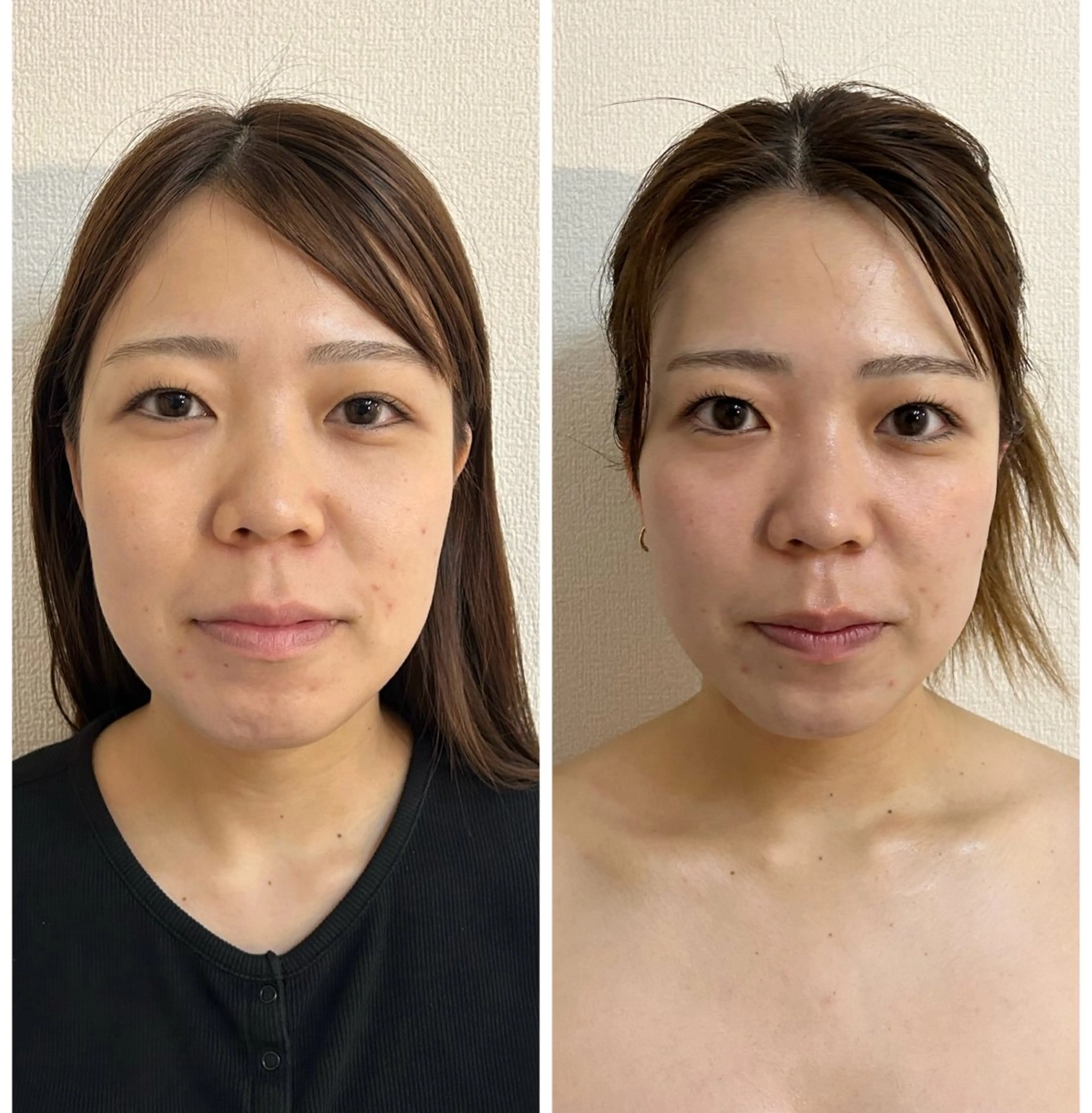 エステ 肌管理 OGUMOのエステ・リラクイメージ