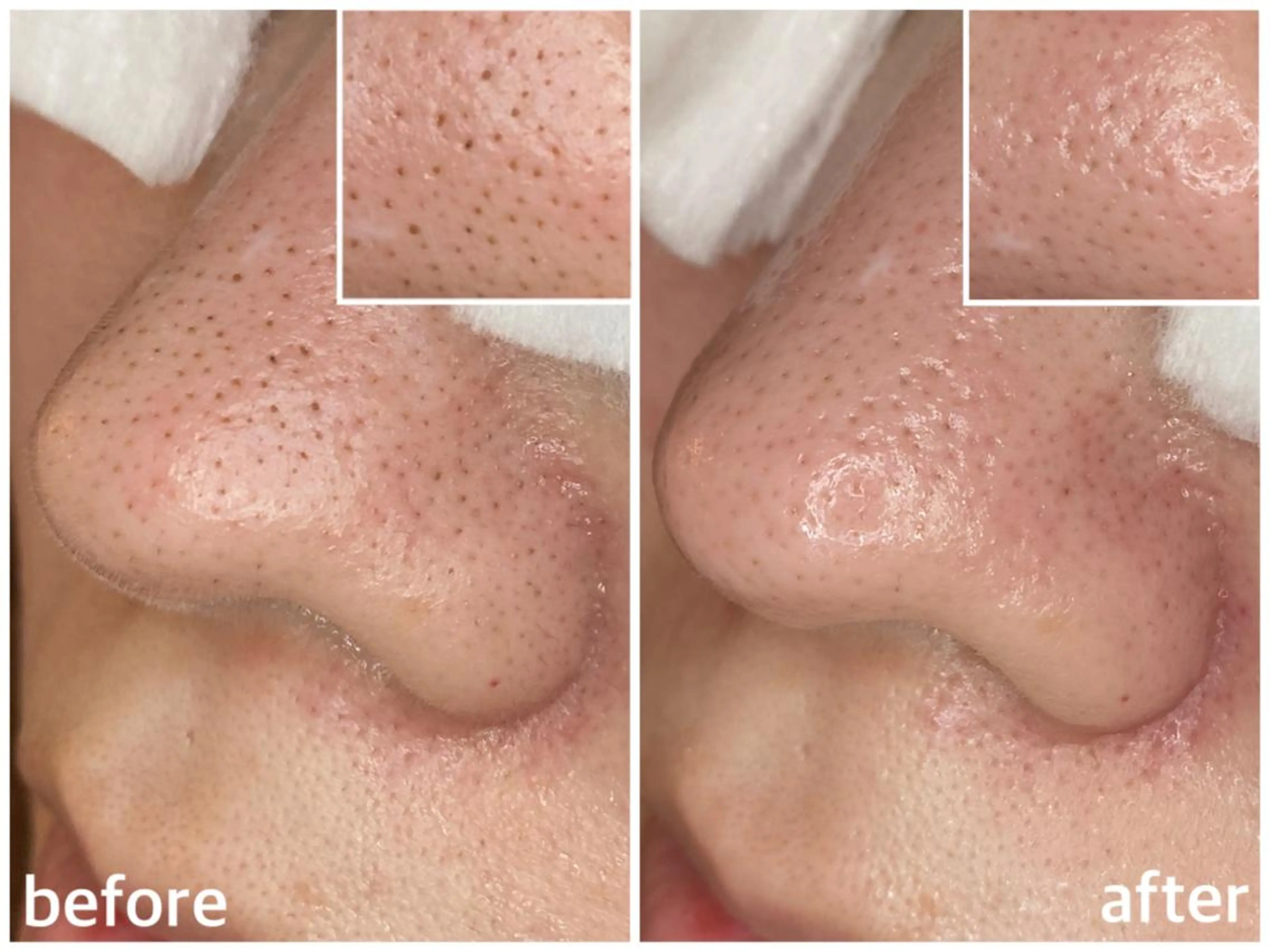 韓国肌管理 【毛穴専科】のエステ・リラクイメージ