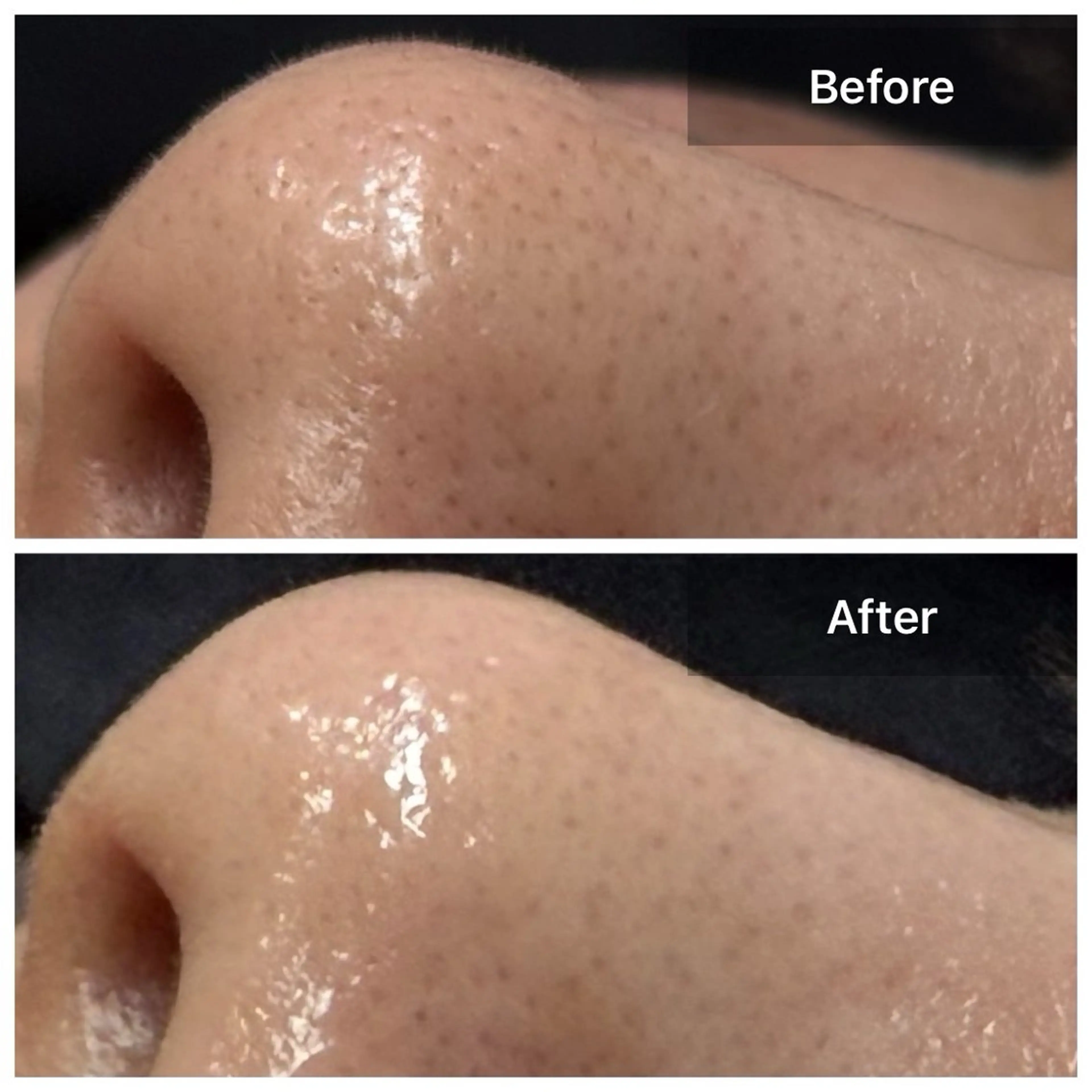 エステ LUNA / Sakikoの眉毛・アイブロウイメージ