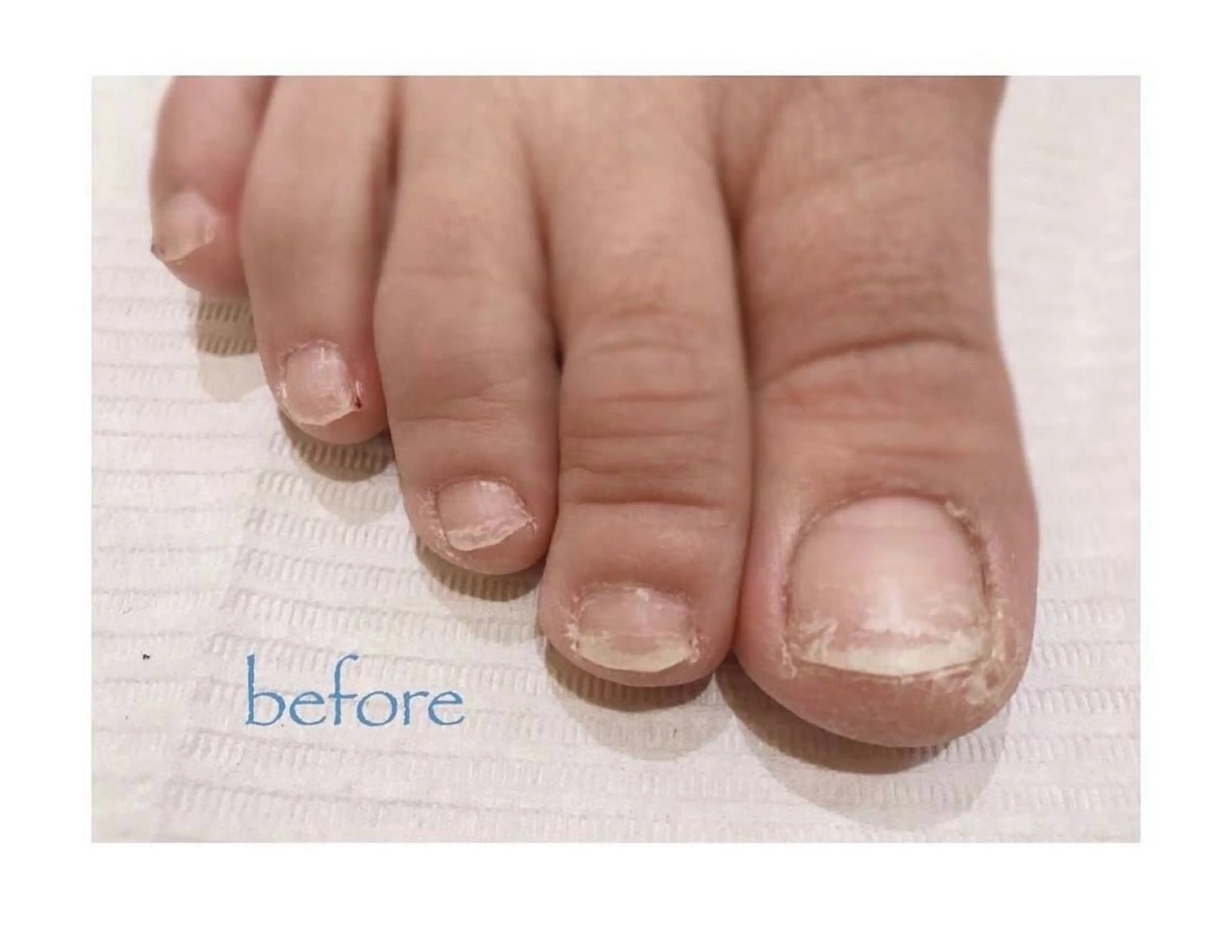 ネイル GREENroom所属・GREEN room 聖蹟桜ヶ丘のネイルデザイン