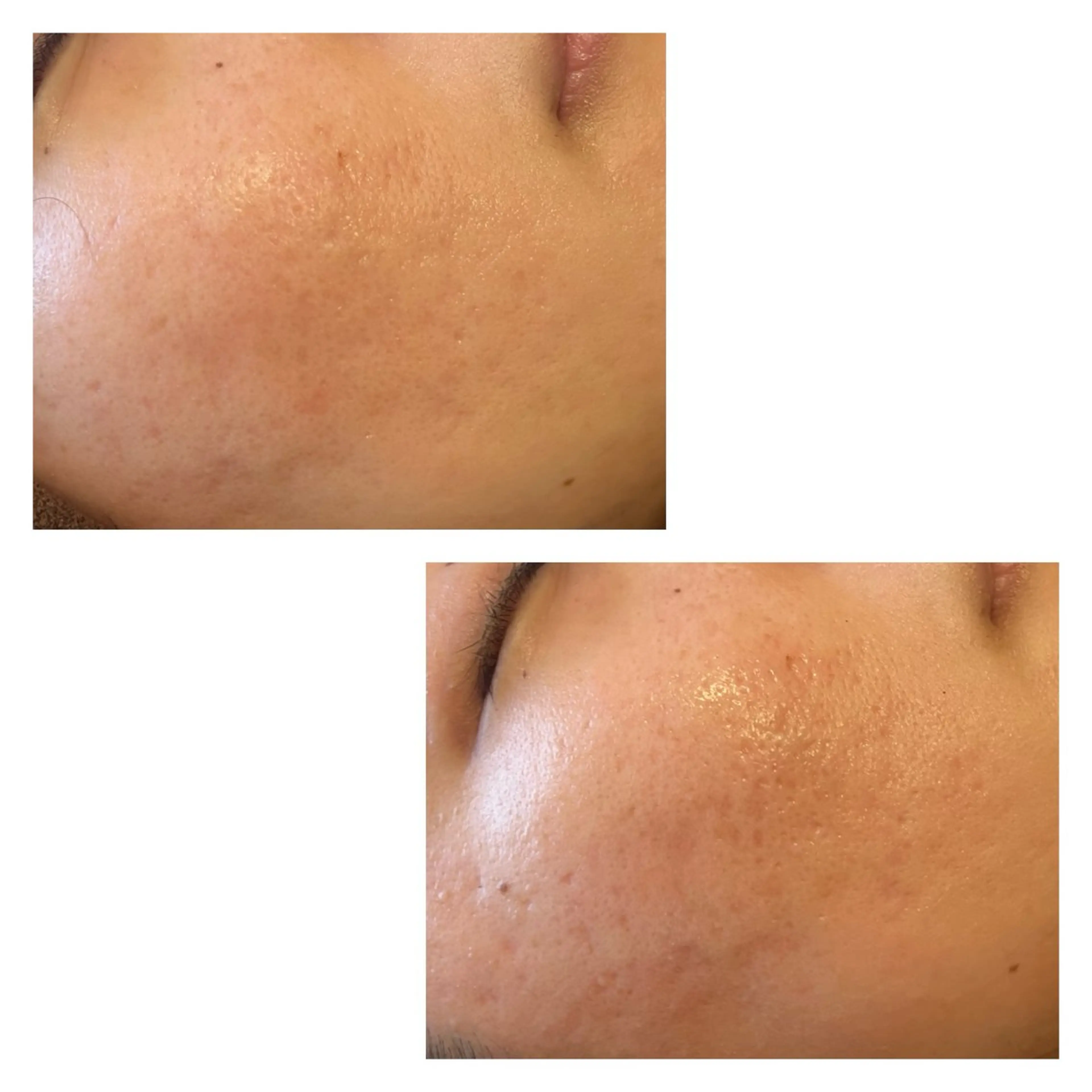 TRUE CARE所属・ハーブピーリング/ 上本町/美肌/幹細胞のエステ・リラクイメージ