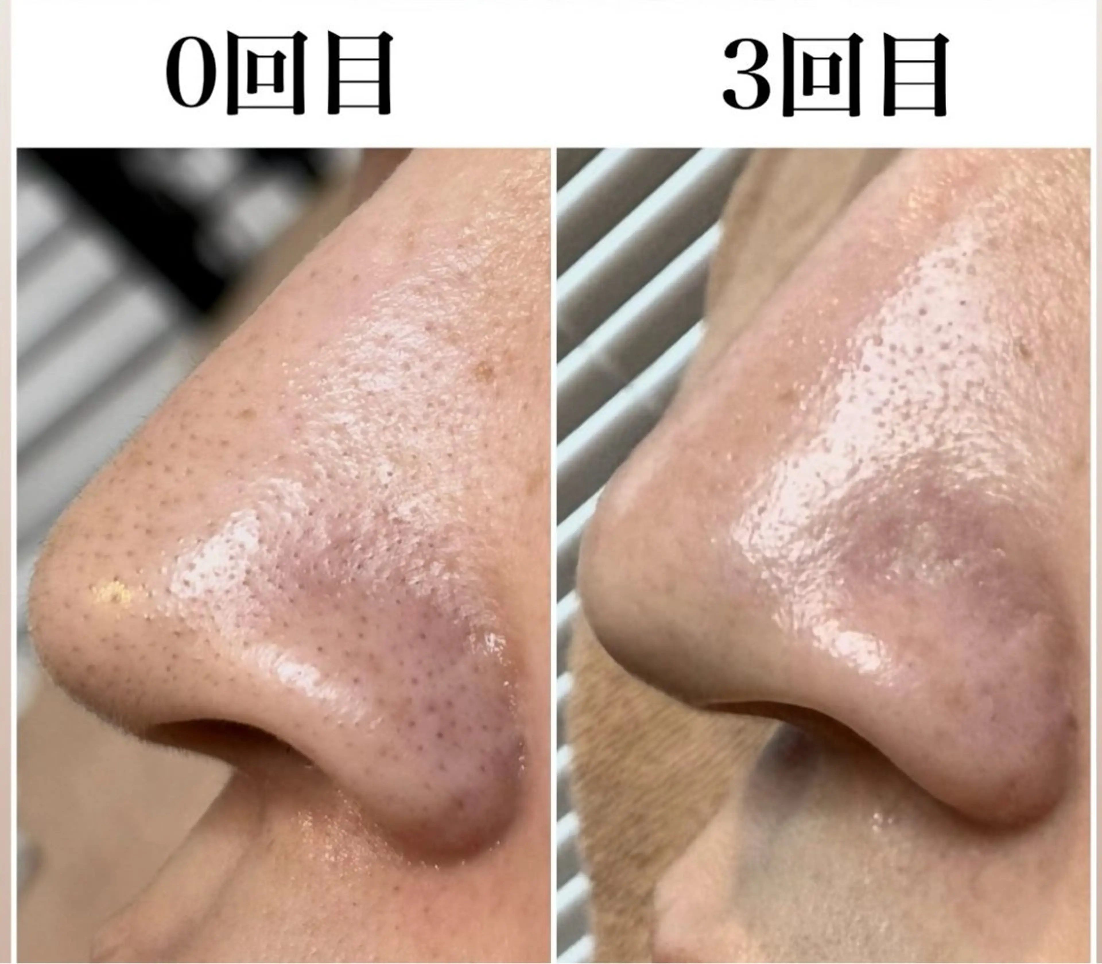 メンズ アイブロウサロンMily所属・眉毛/美肌の専門店 Mily🍒ミウィの眉毛・アイブロウイメージ