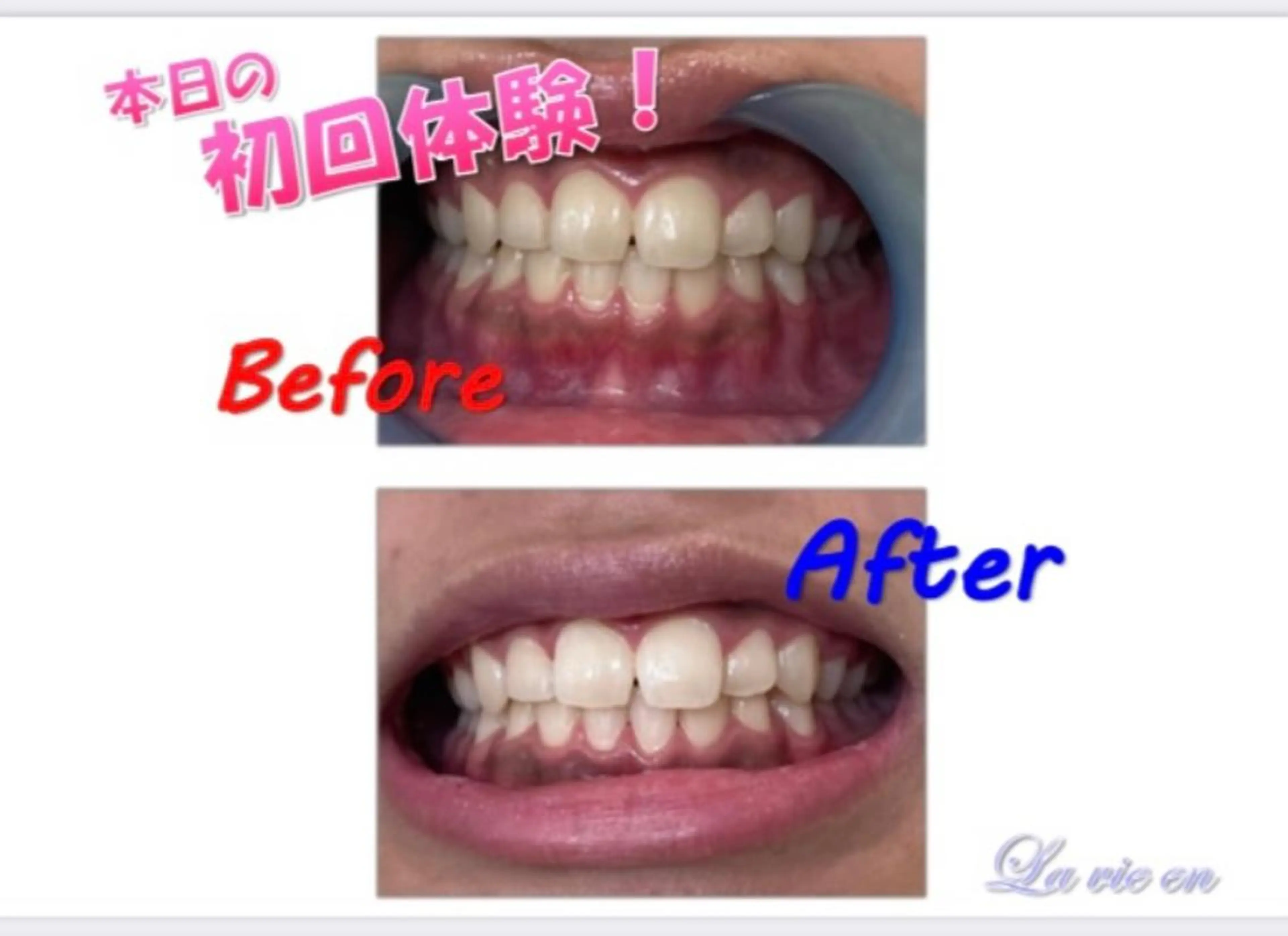 その他 セルフホワイトニングサロン　ラヴィアン所属・ホワイトニングサロン La vie enのその他イメージ