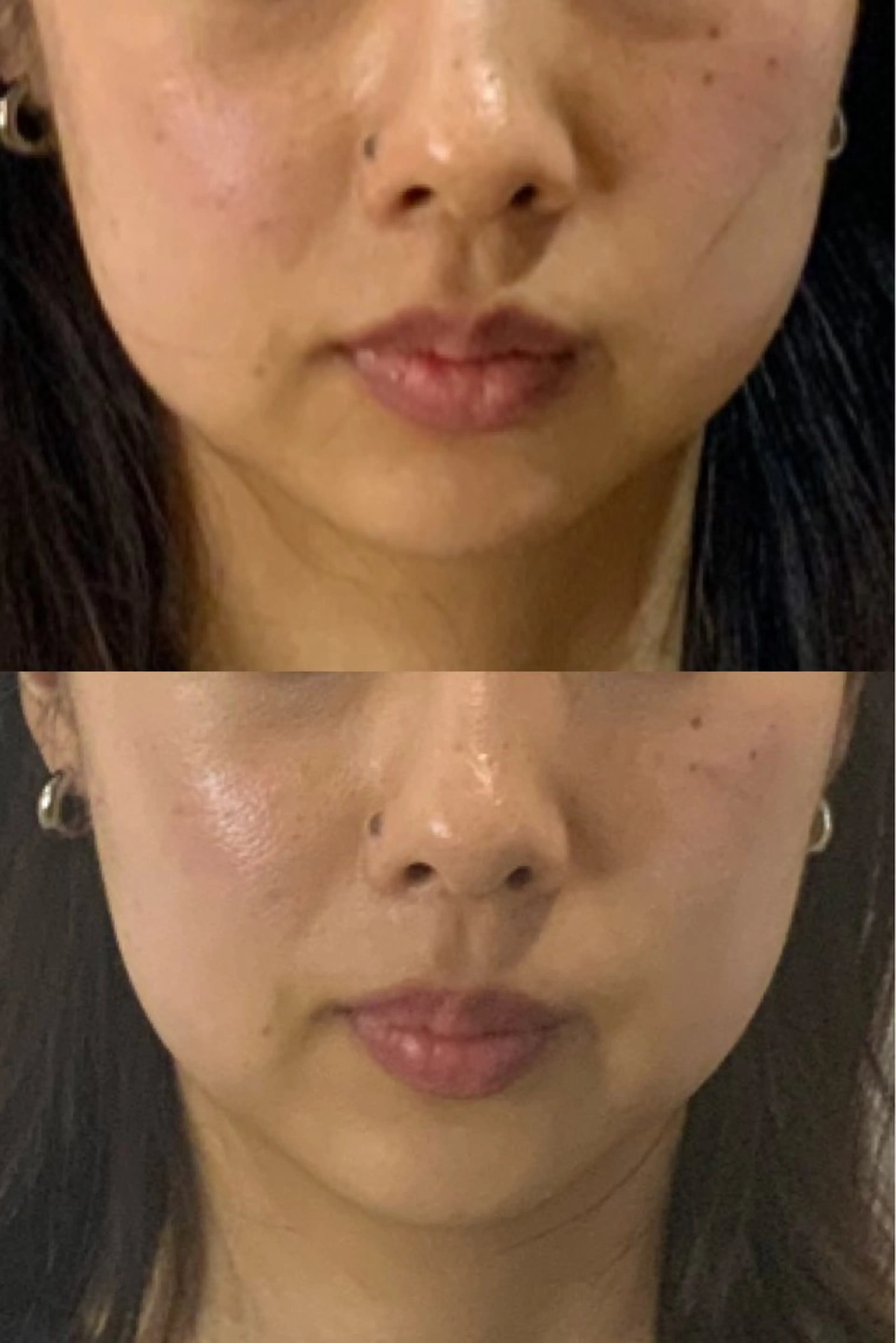 エステ リラク 最速小顔・肌質管理 espoirマキのエステ・リラクイメージ