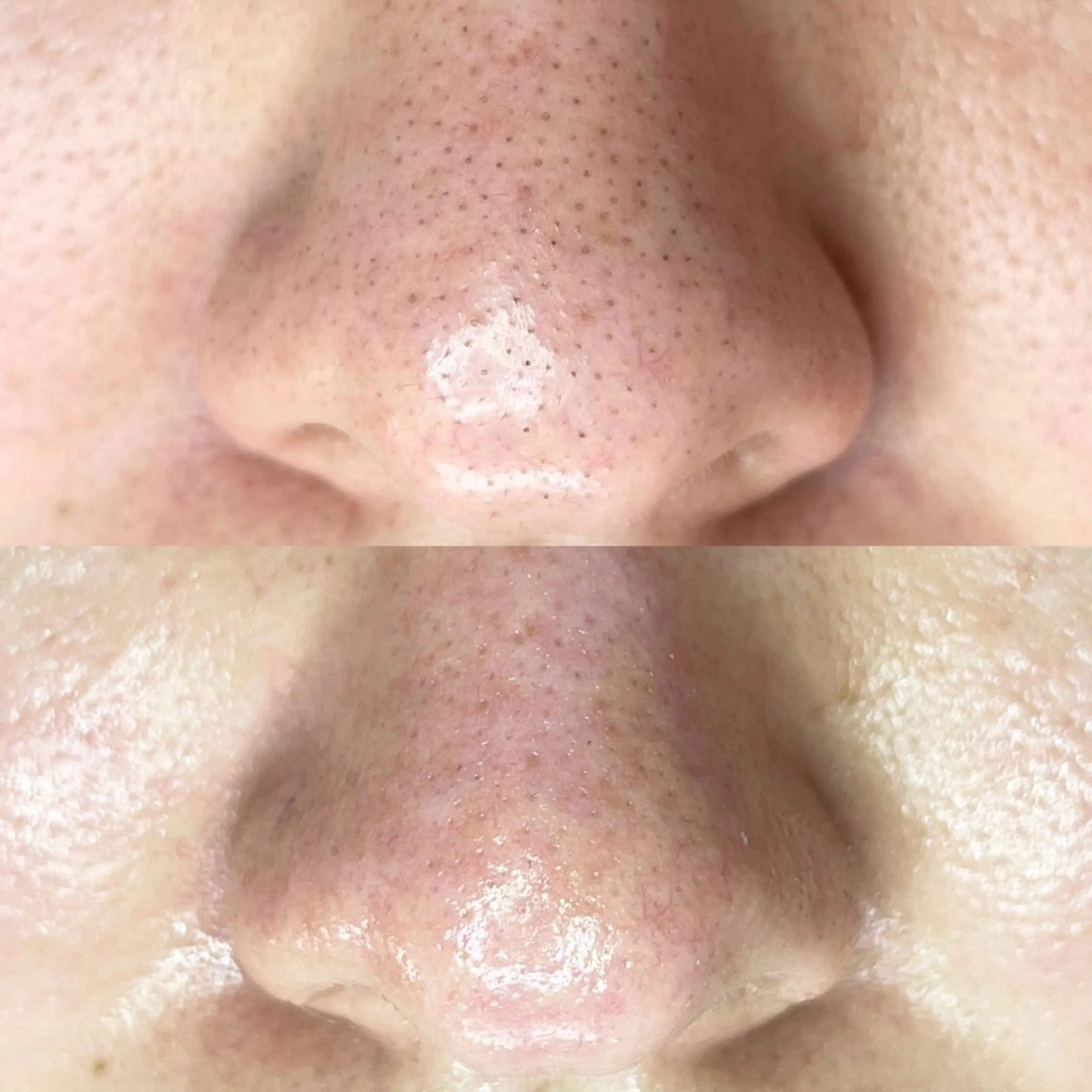 毛穴・頭皮 専門店💪のその他イメージ