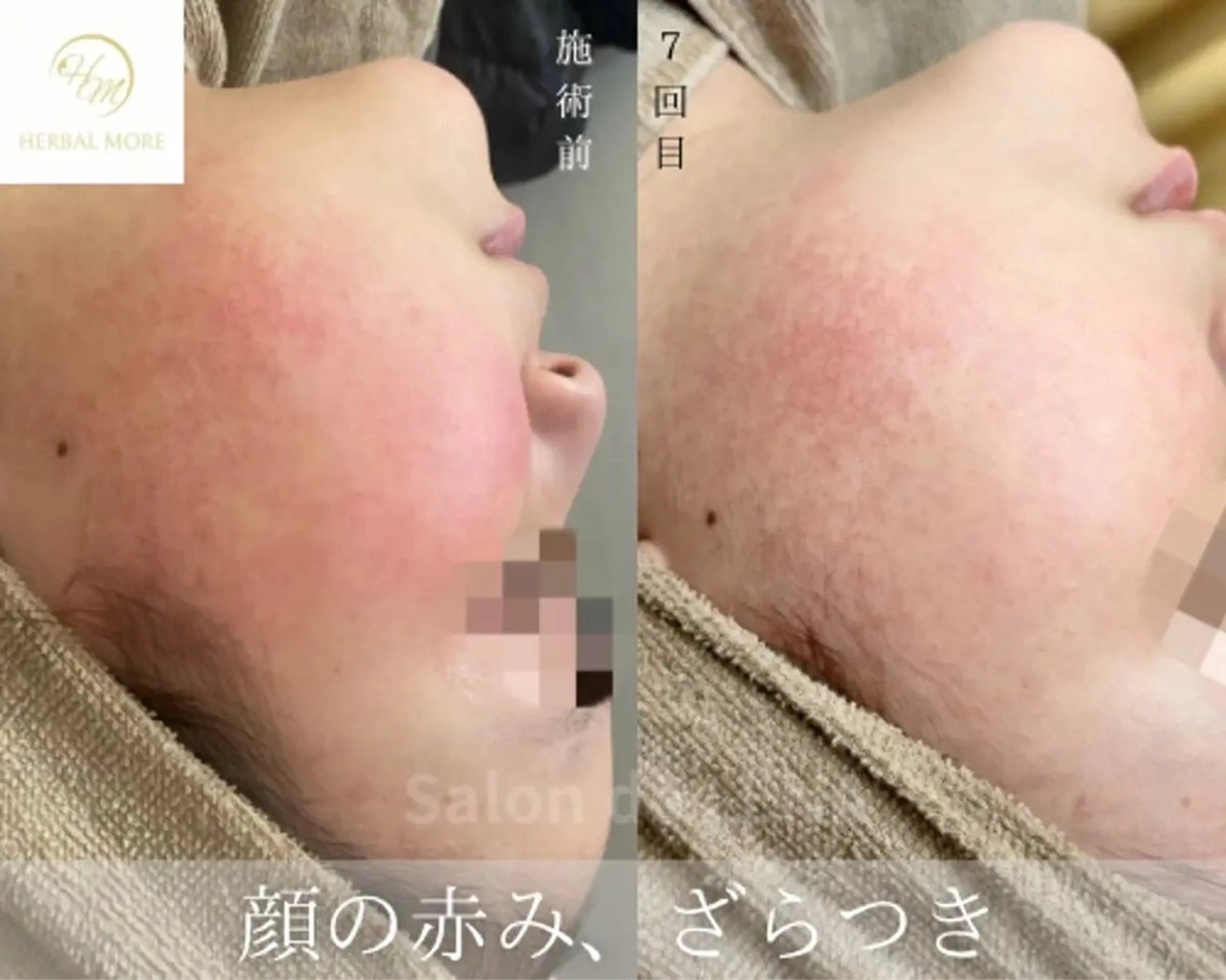 ハーブピーリング専門 グランディール　武内のエステ・リラクイメージ