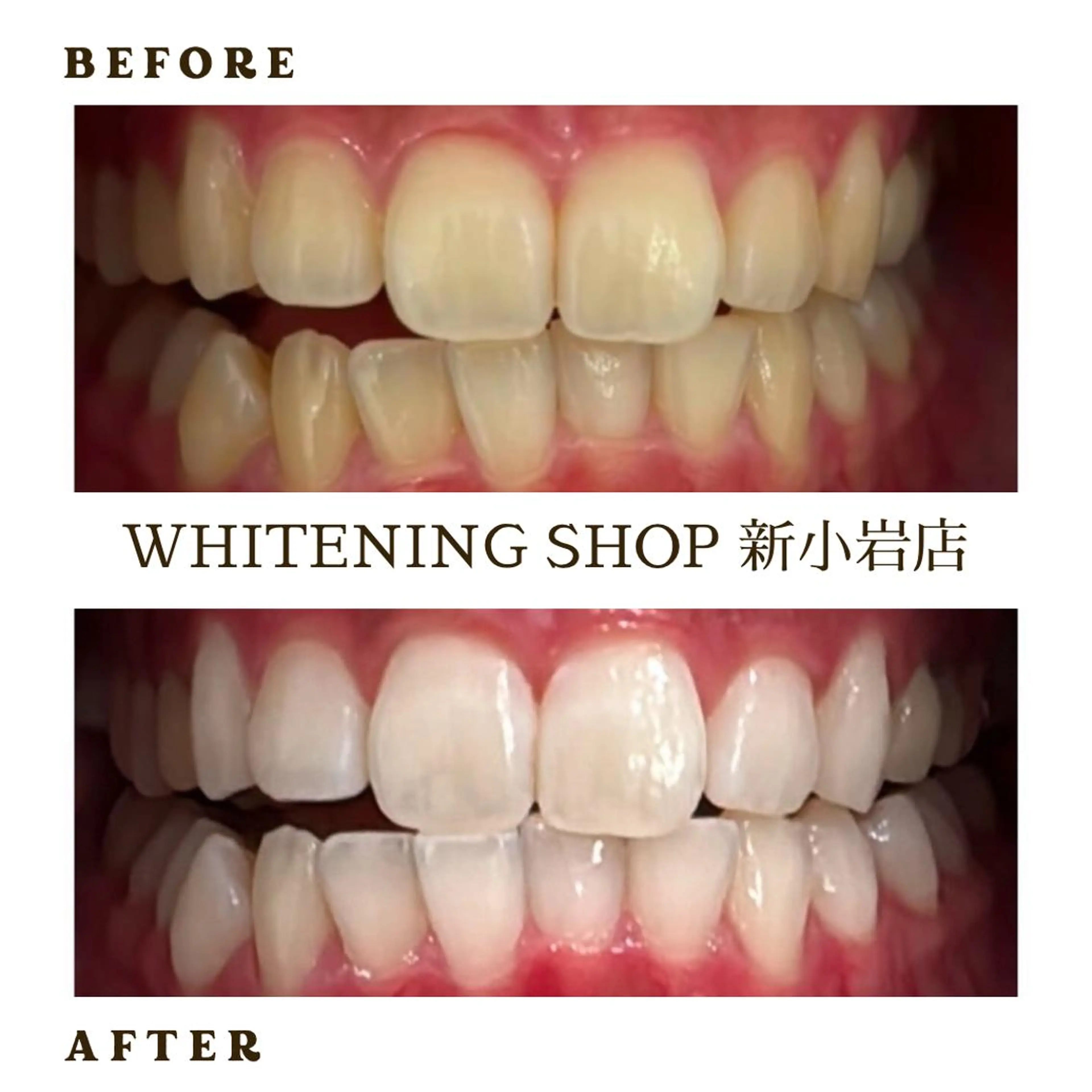 メンズ その他 ホワイトニング ショップ新小岩店のその他イメージ
