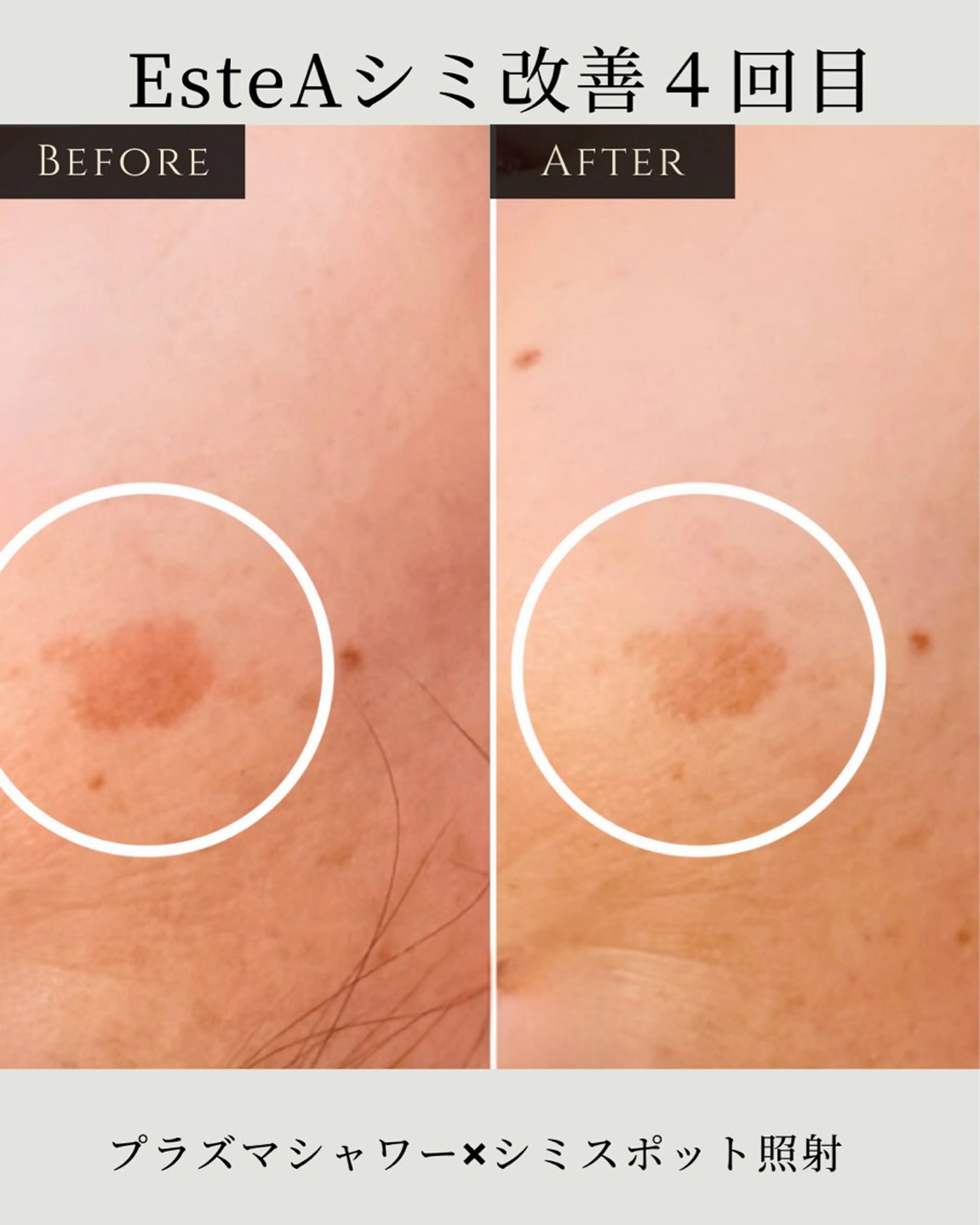 稲垣 優のエステ・リラクイメージ