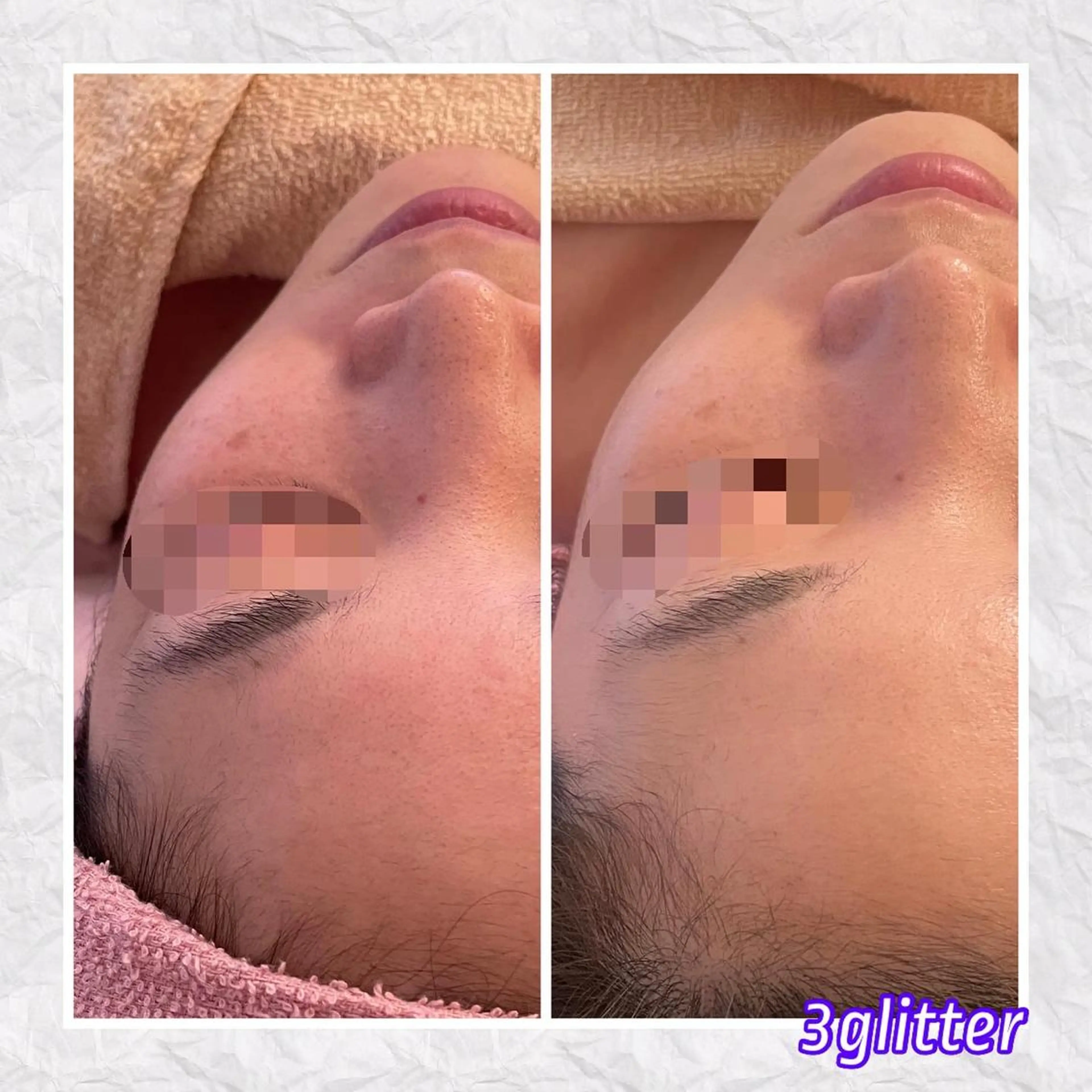 3glitter 肌質改善＆痩身のエステ・リラクイメージ