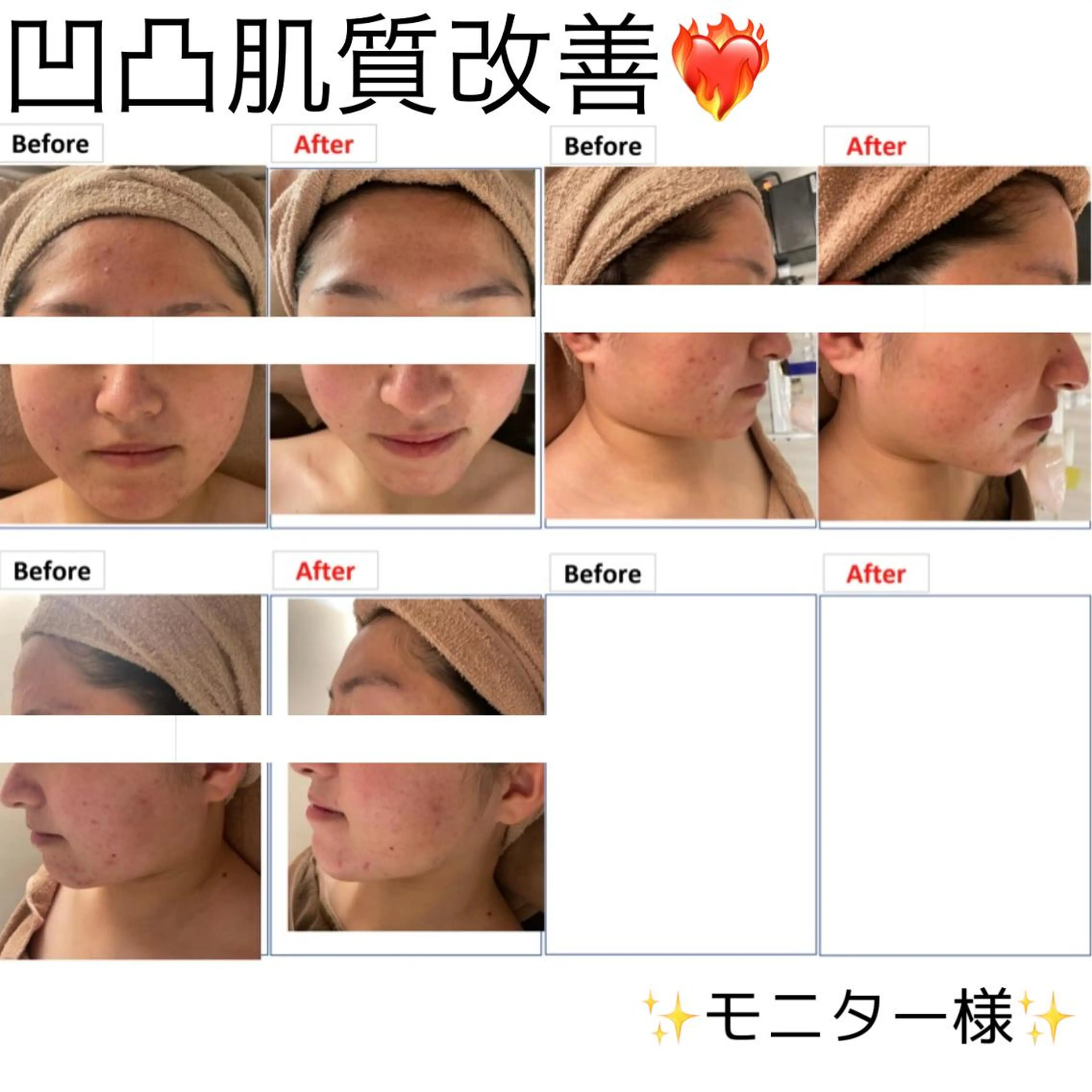 脱毛 レイビス 渋谷店波間❤️のエステ・リラクイメージ