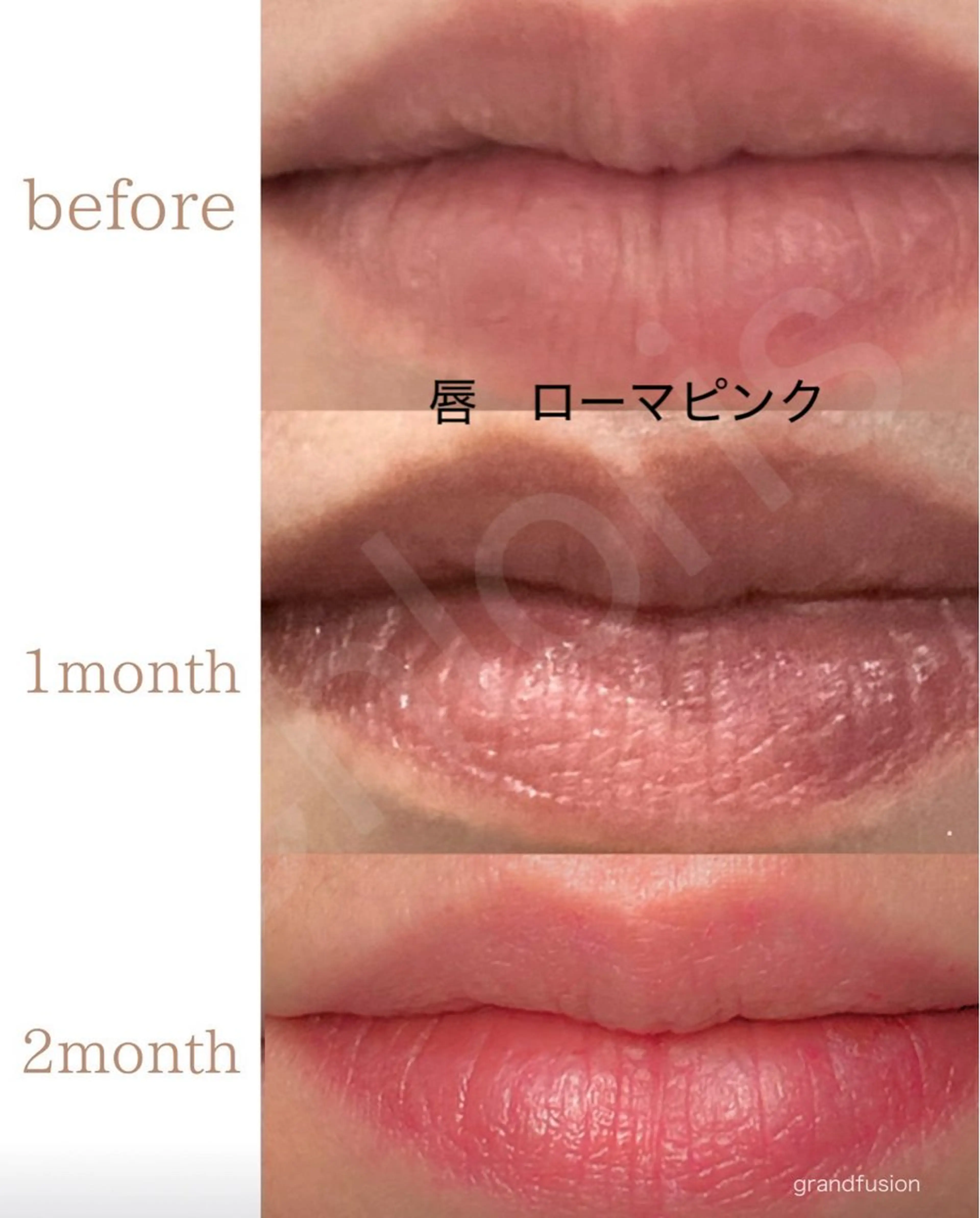 川越デリケートゾーン 光脱毛/ワックス脱毛のエステ・リラクイメージ