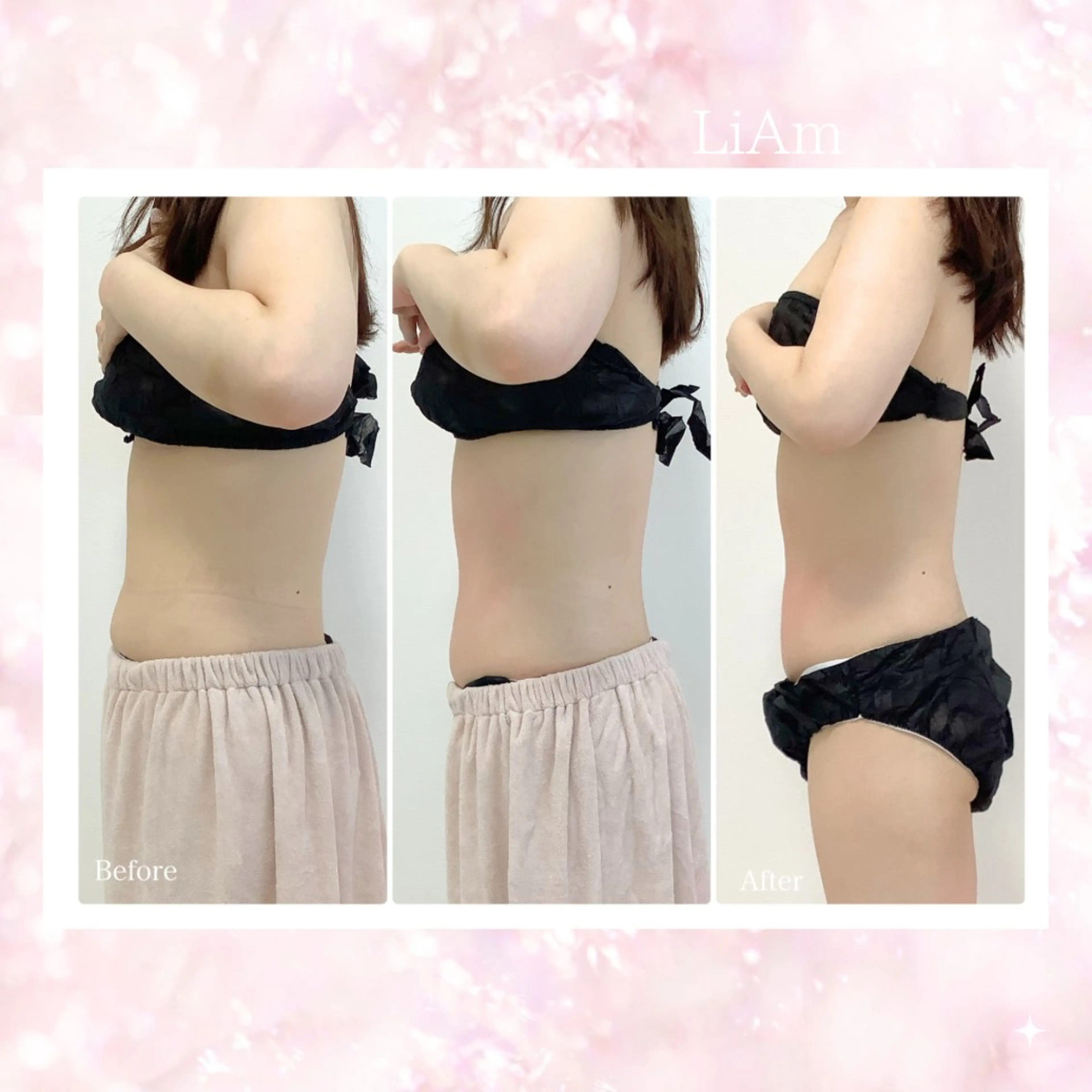 LiAm《美肌管理/ 小顔/脂肪ケア》のその他イメージ