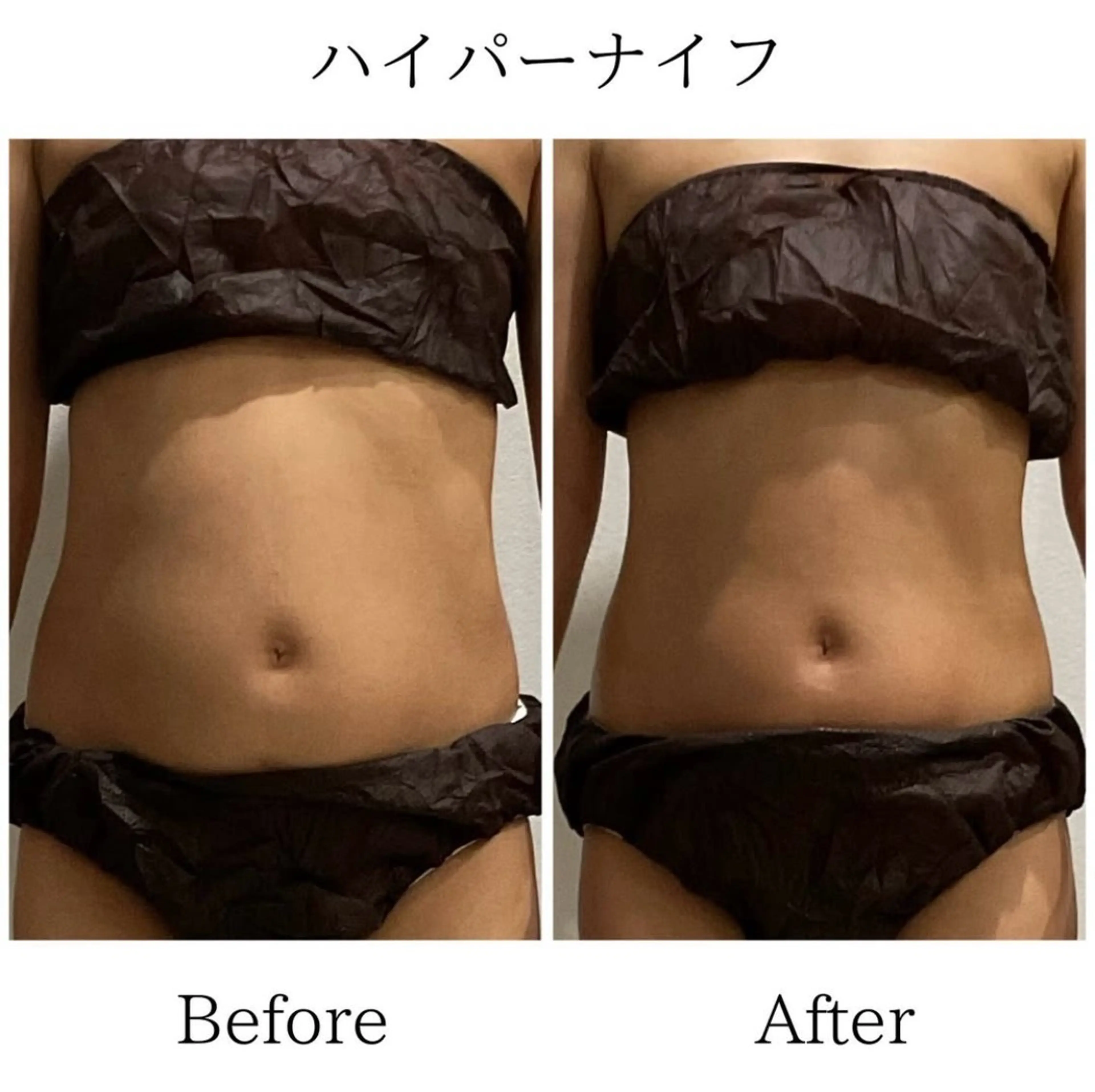 エステ LiLL 熊本のエステ・リラクイメージ