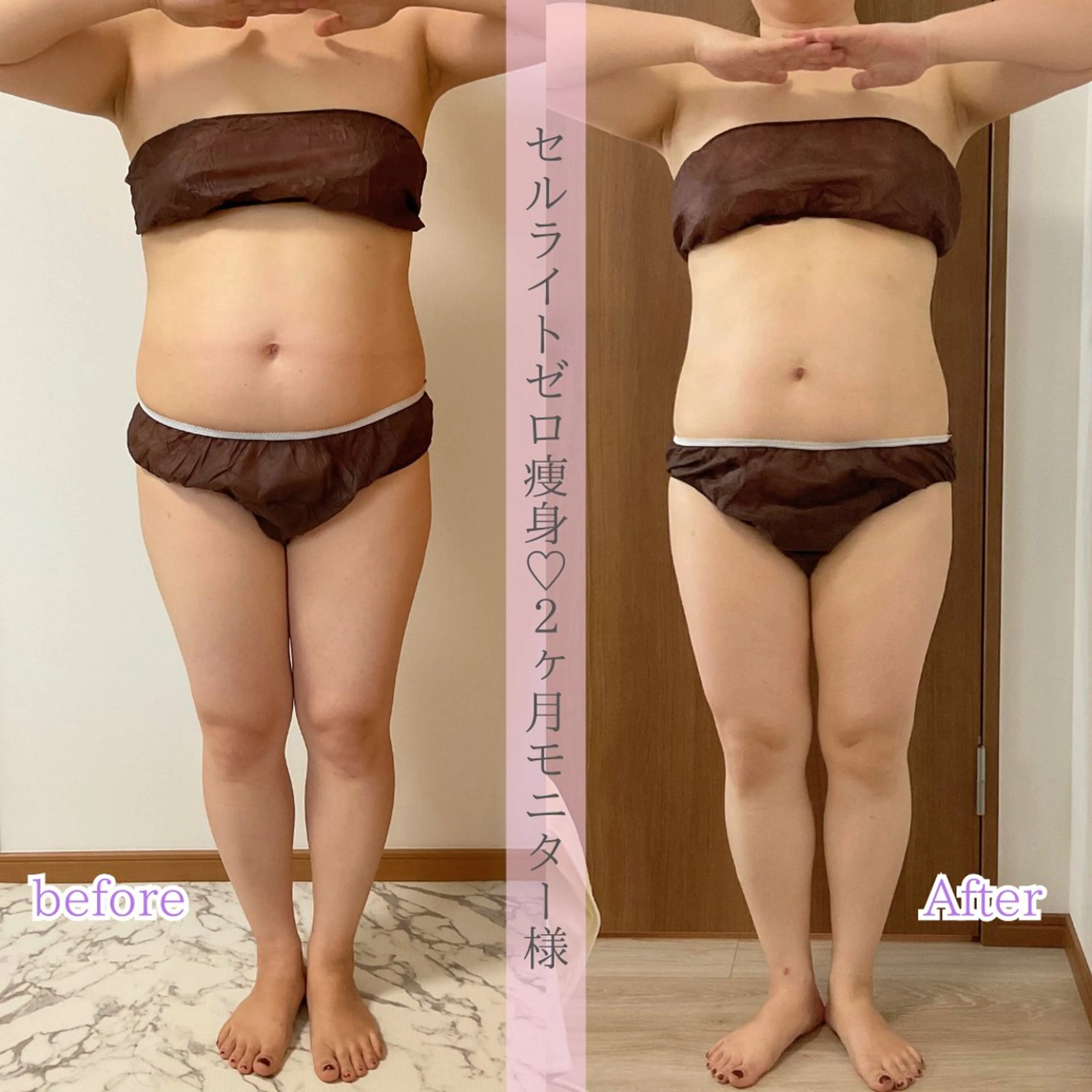 肌質改善サロン ココマヒナのエステ・リラクイメージ