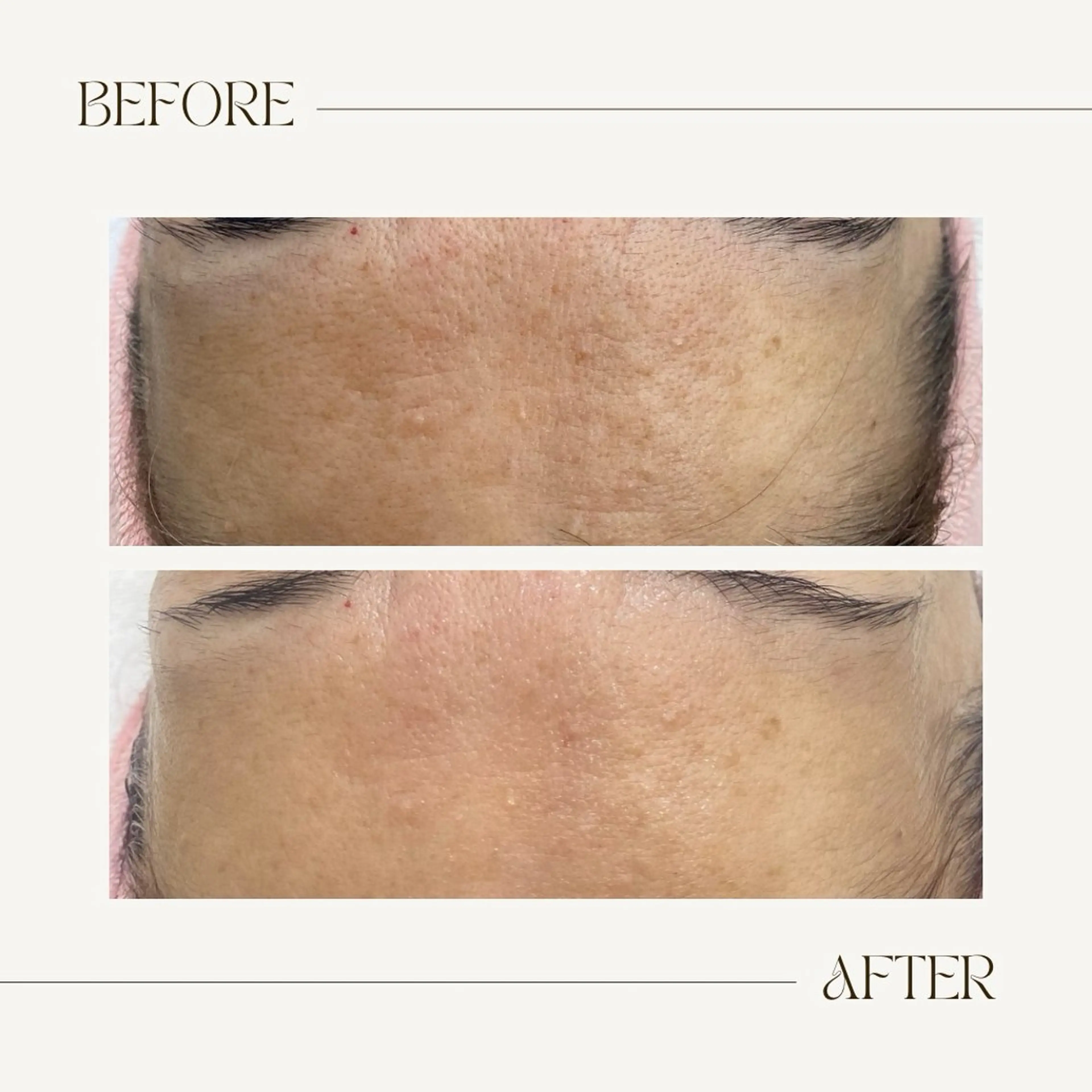 CEsalonEgg 齋藤のエステ・リラクイメージ