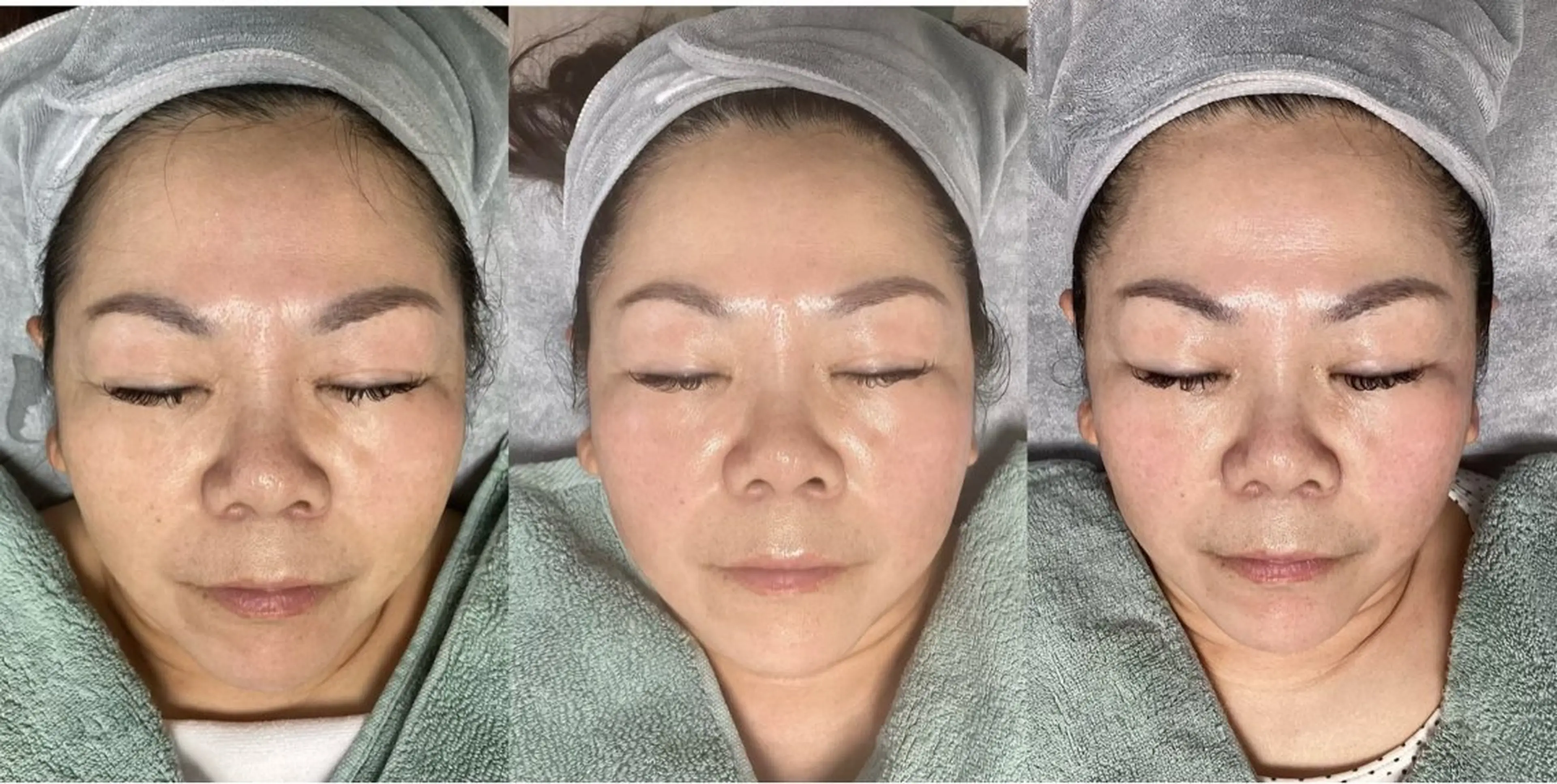 エステ リラク ホワイティアビシェル ウラワ 白澤奇のエステ・リラクイメージ