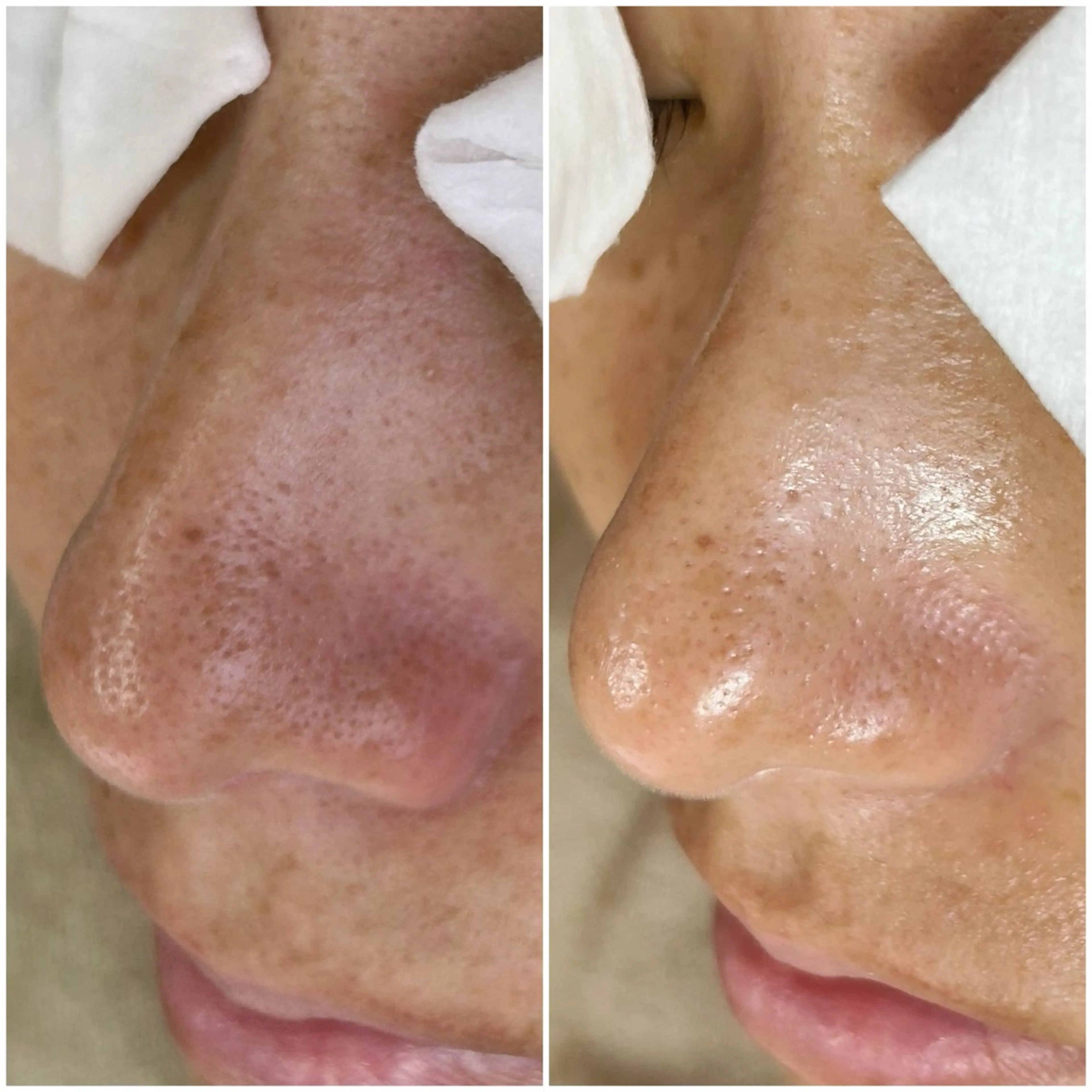 毛穴洗浄専門店/ 泉佐野/oluoluのエステ・リラクイメージ