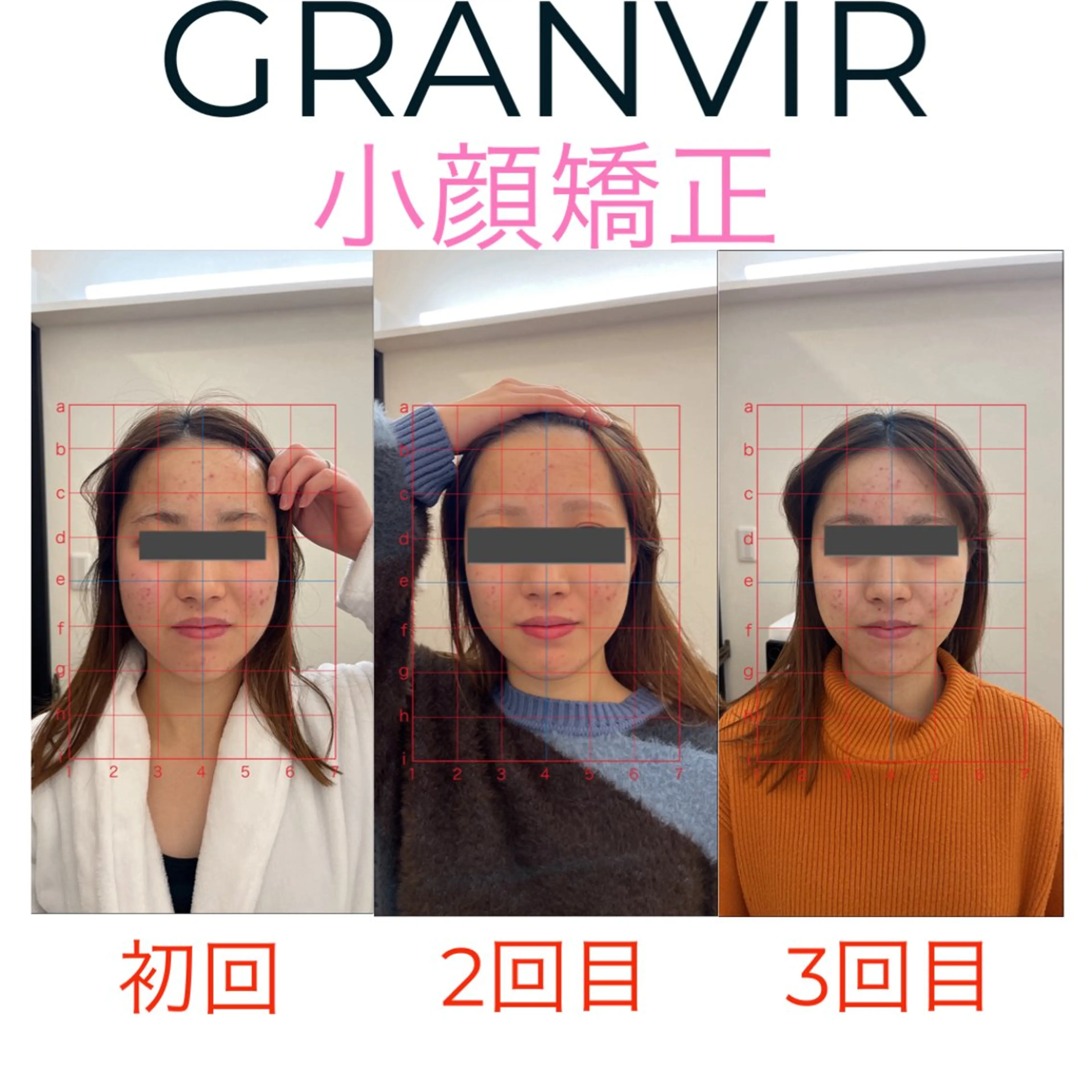 GRANVIR グランヴィールのエステ・リラクイメージ