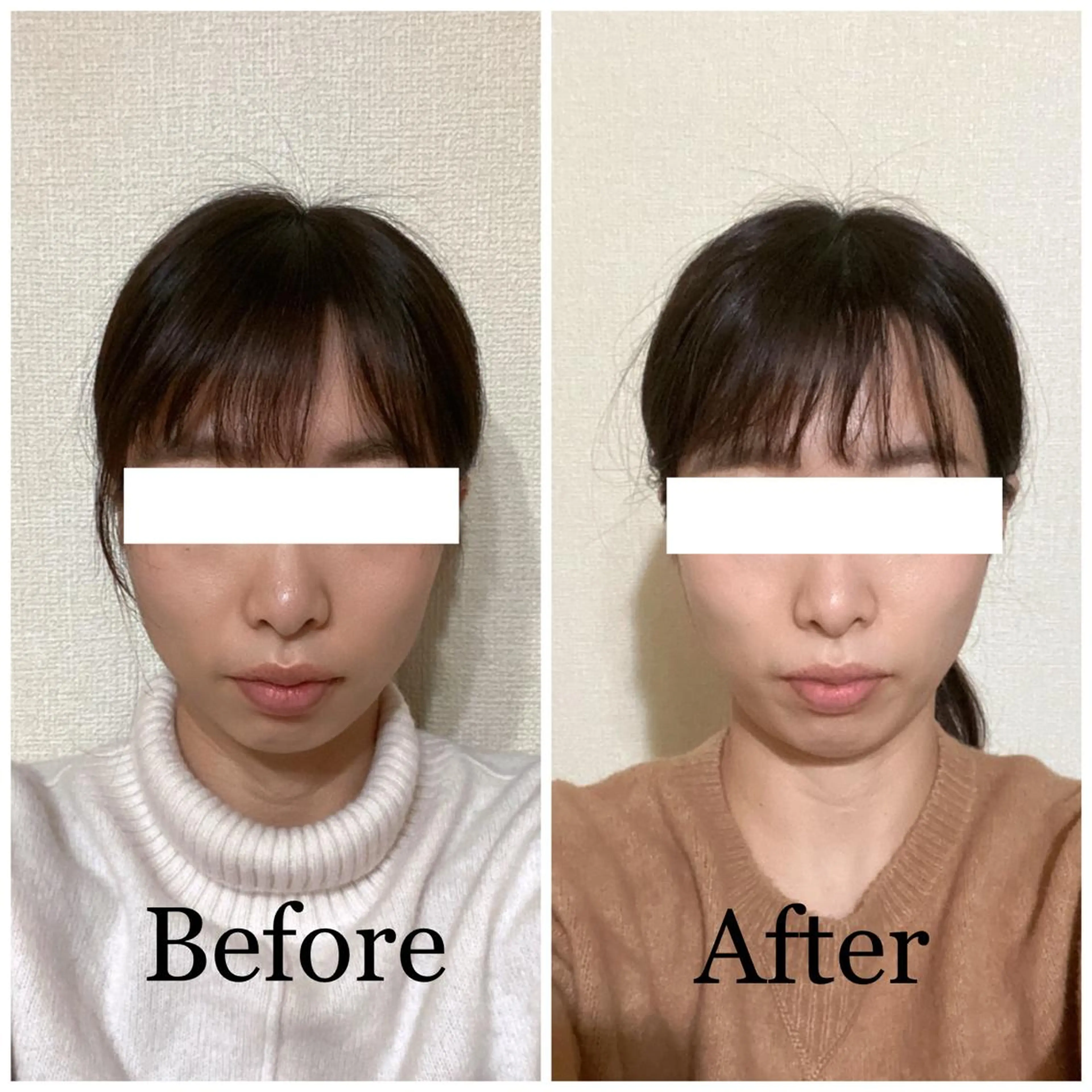 小顔矯正サロン AYURのエステ・リラクイメージ