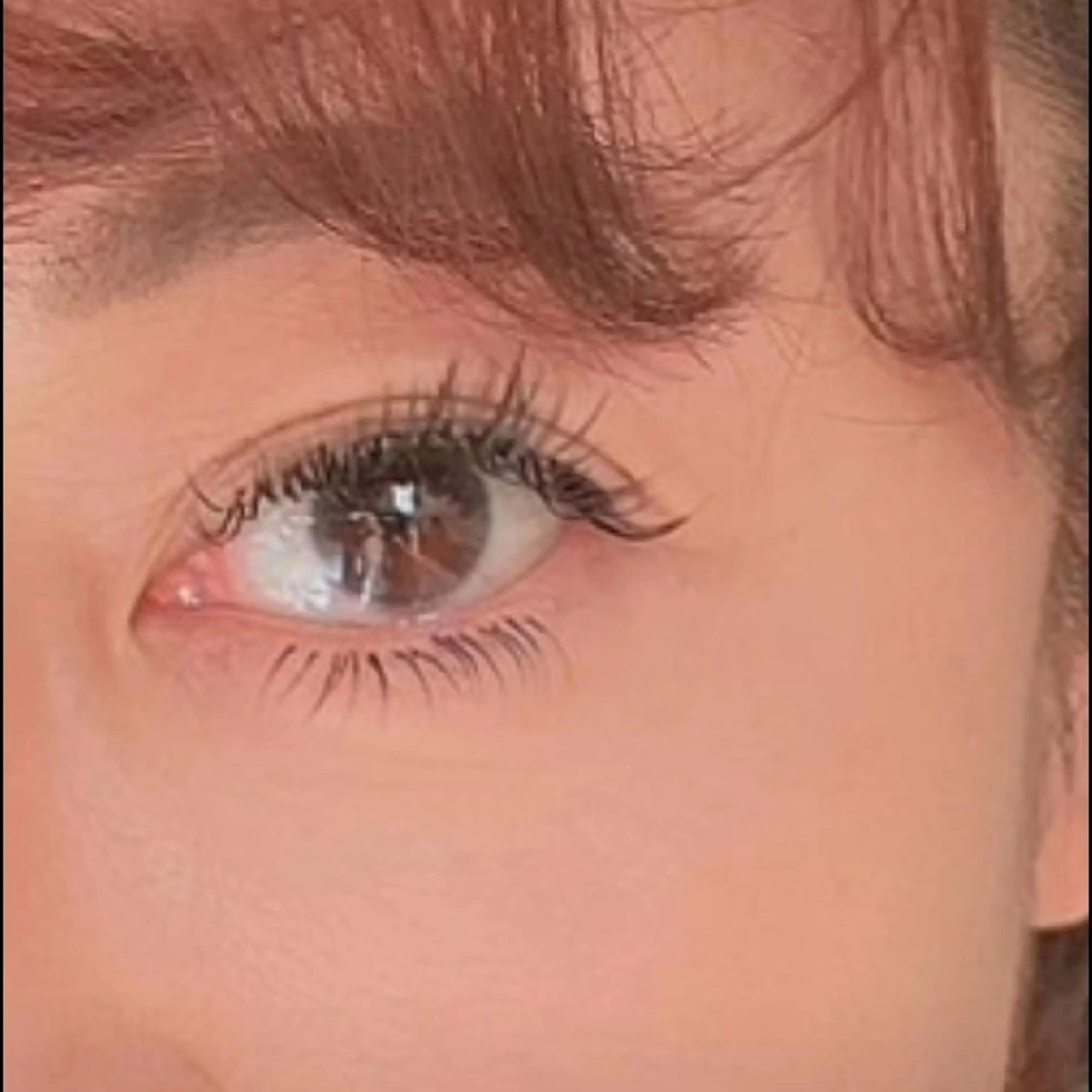 ミニモセール！！！！！[ボトックスパック]でお顔のエイジングの写真