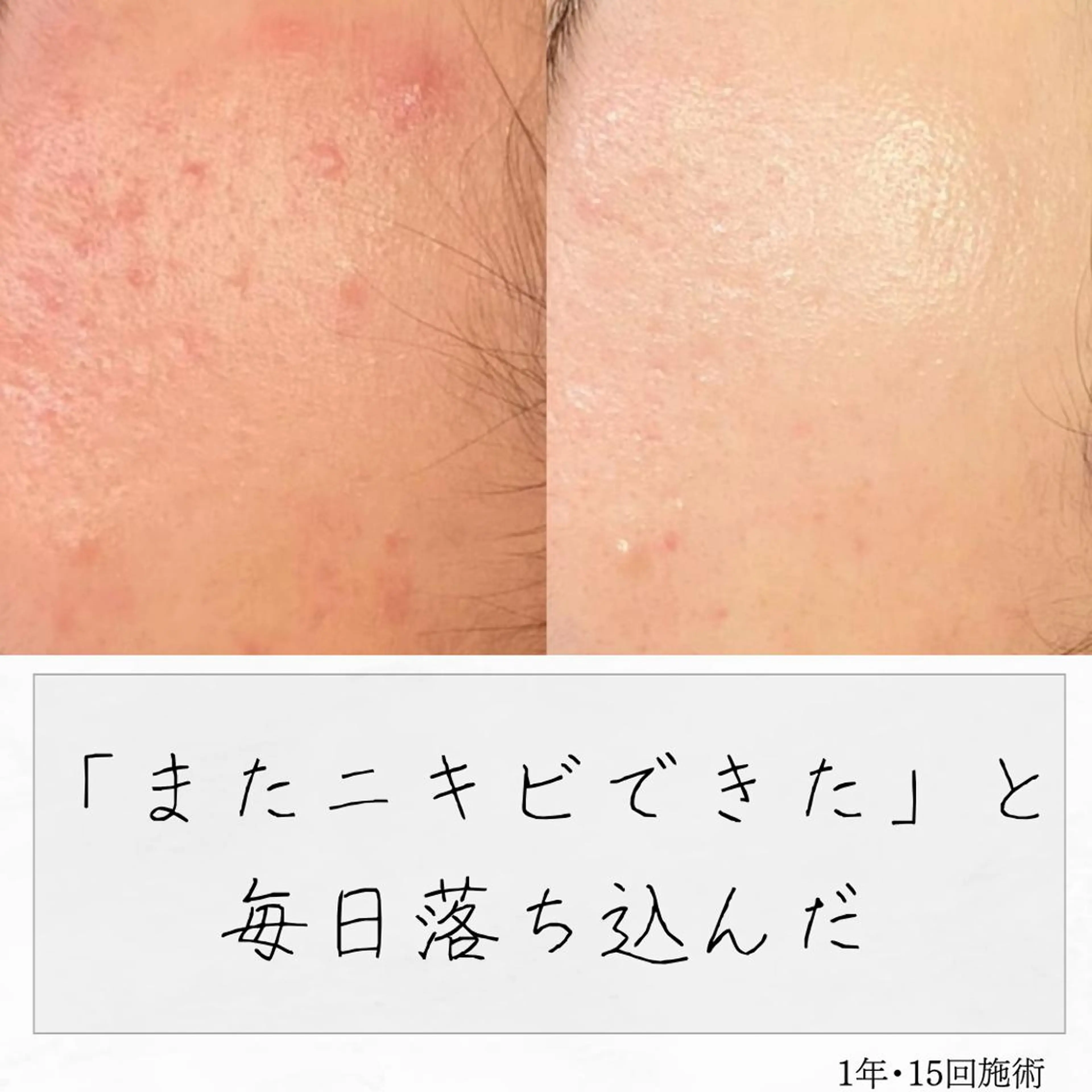 ニキビ経験者が施術 する専門サロン🌻のエステ・リラクイメージ