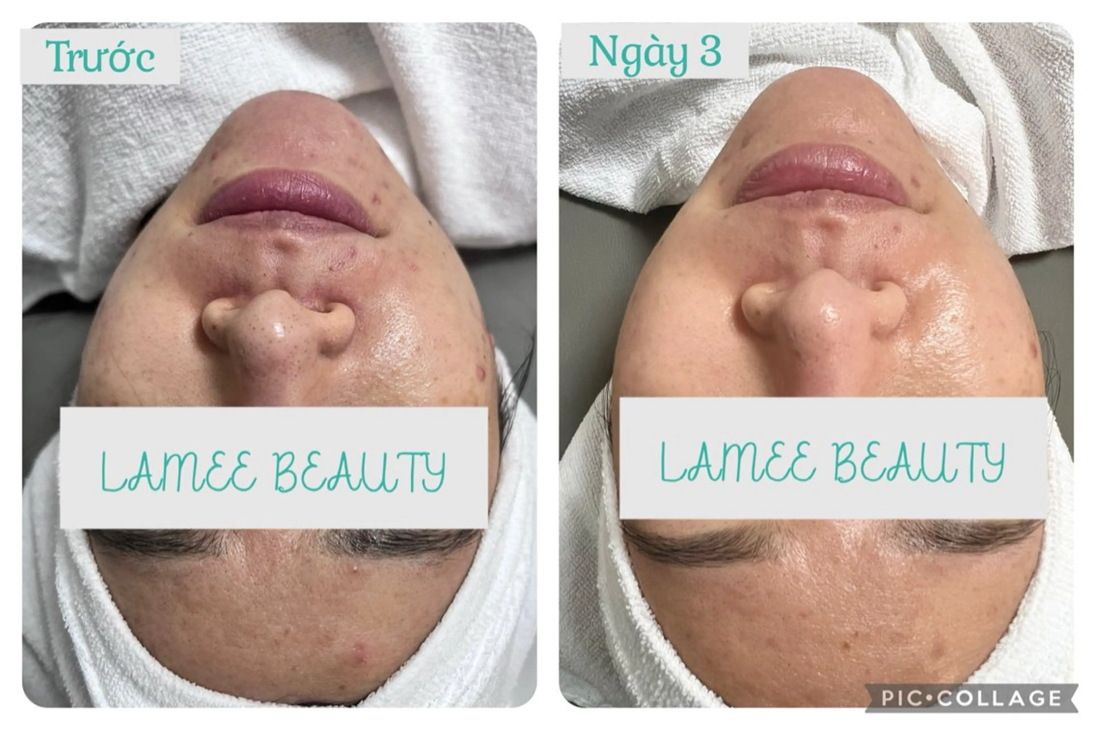 LAMEE BEAUTY所属・LAMEE BEAUTYのエステ・リラクイメージ