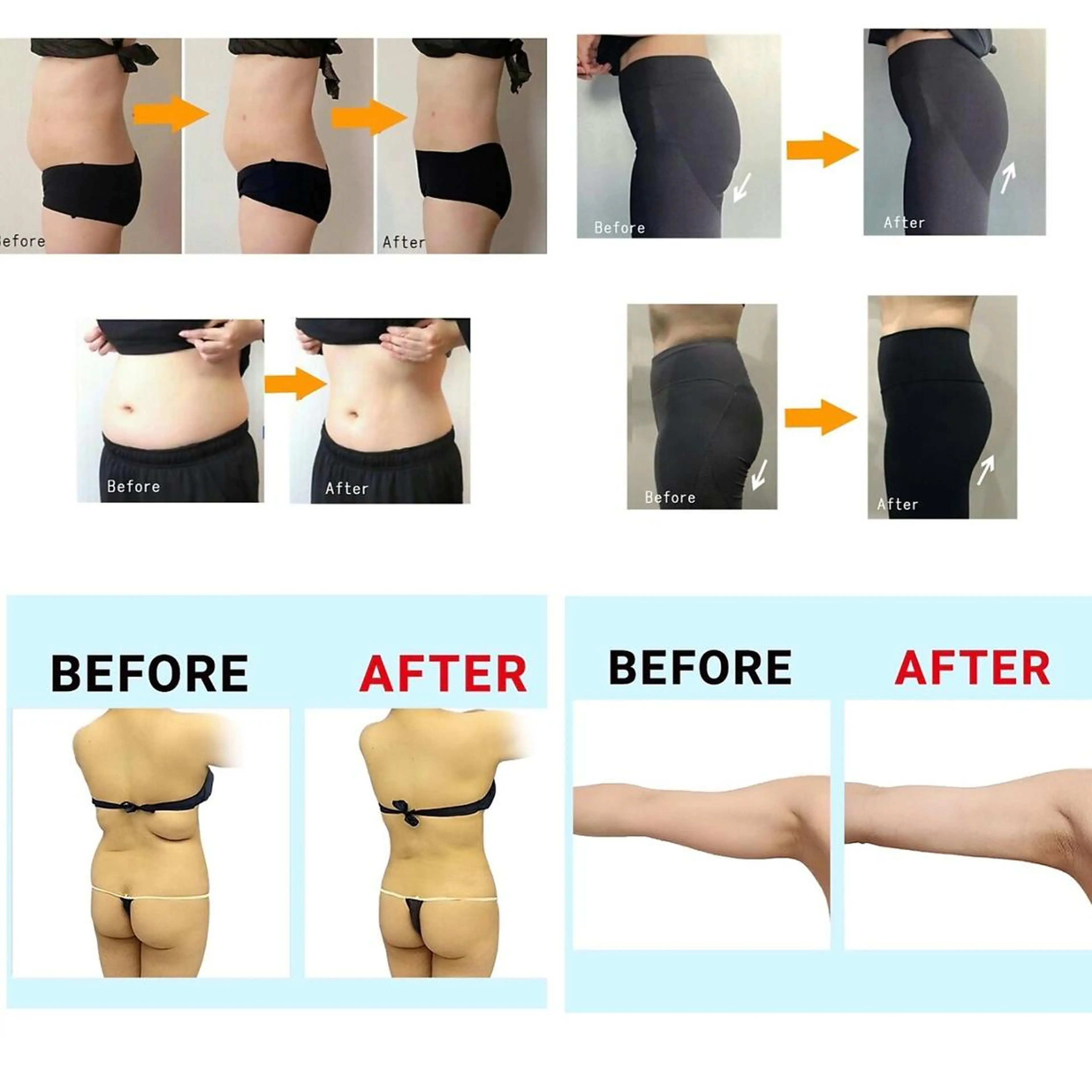 ☆エリア初☆TVya SNSで話題の冷却ダイエット4cup&次世代EMS4箇所を選び効果的痩身メニュー♪¥22440の写真