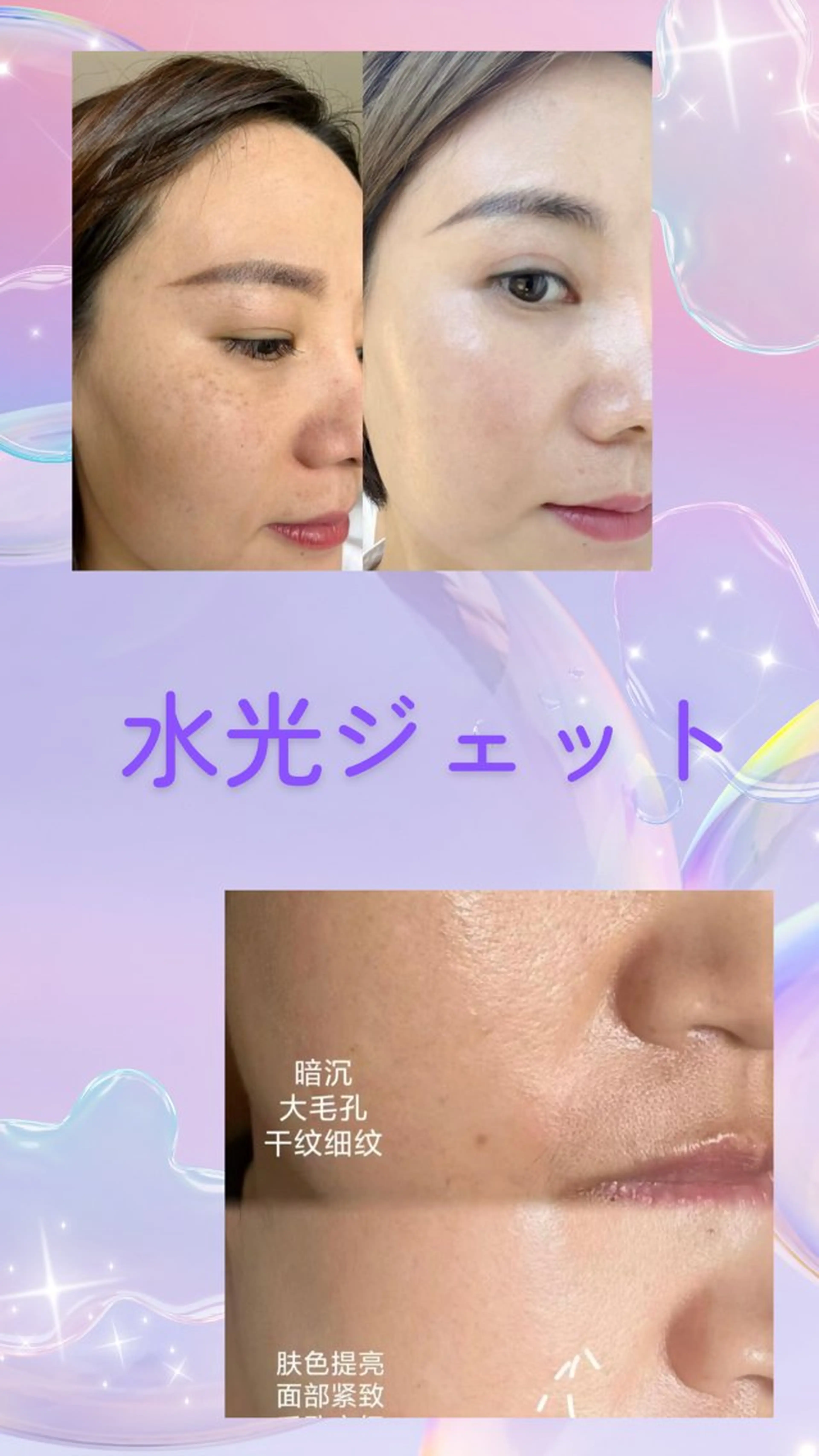 マツエク・マツパ 結婚式・ブライダル エステ リラク 愛維美水光美肌専門店 メンズレディースokのエステ・リラクイメージ