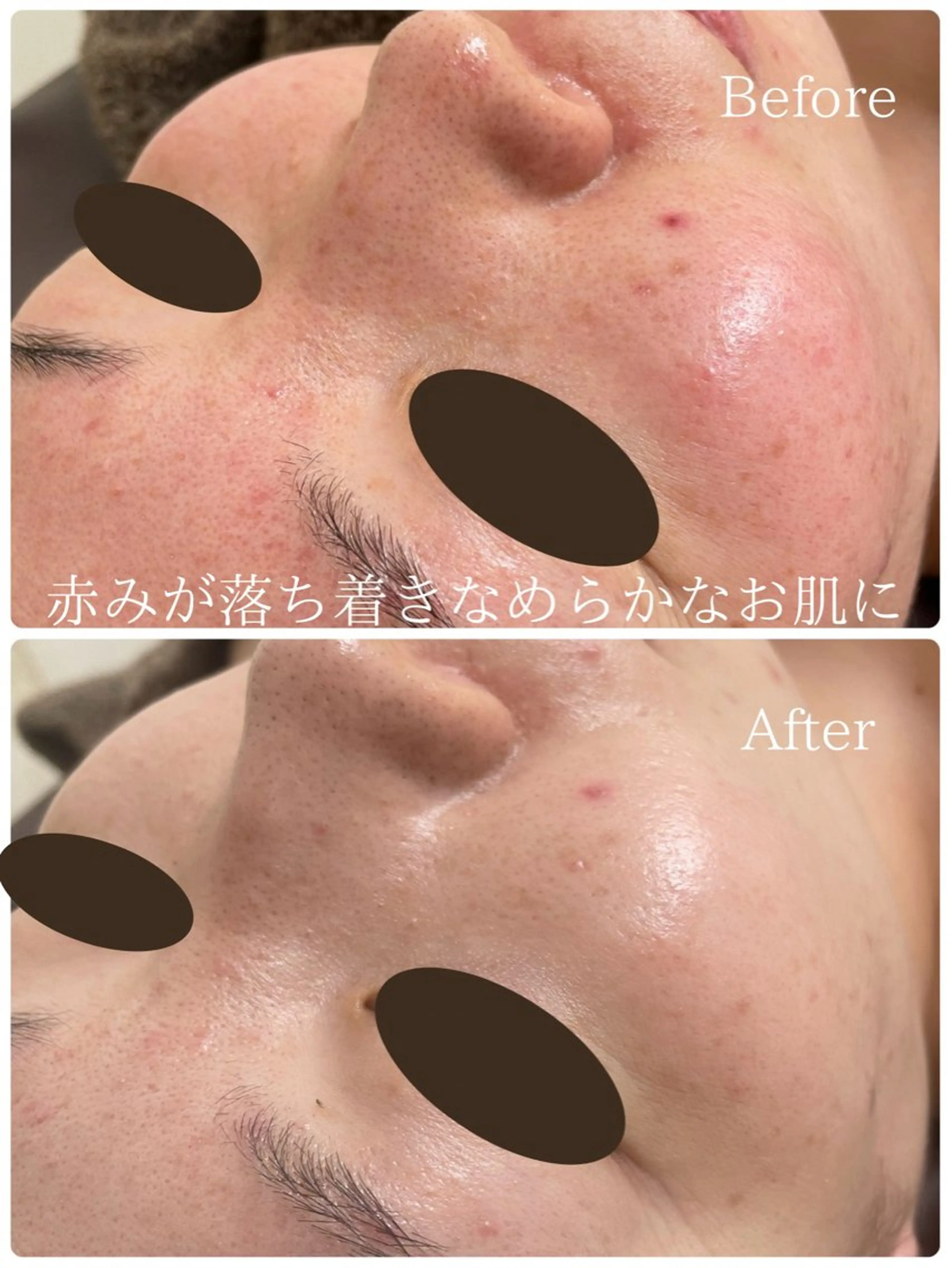 ルタンリッシュ さいたま店のエステ・リラクイメージ