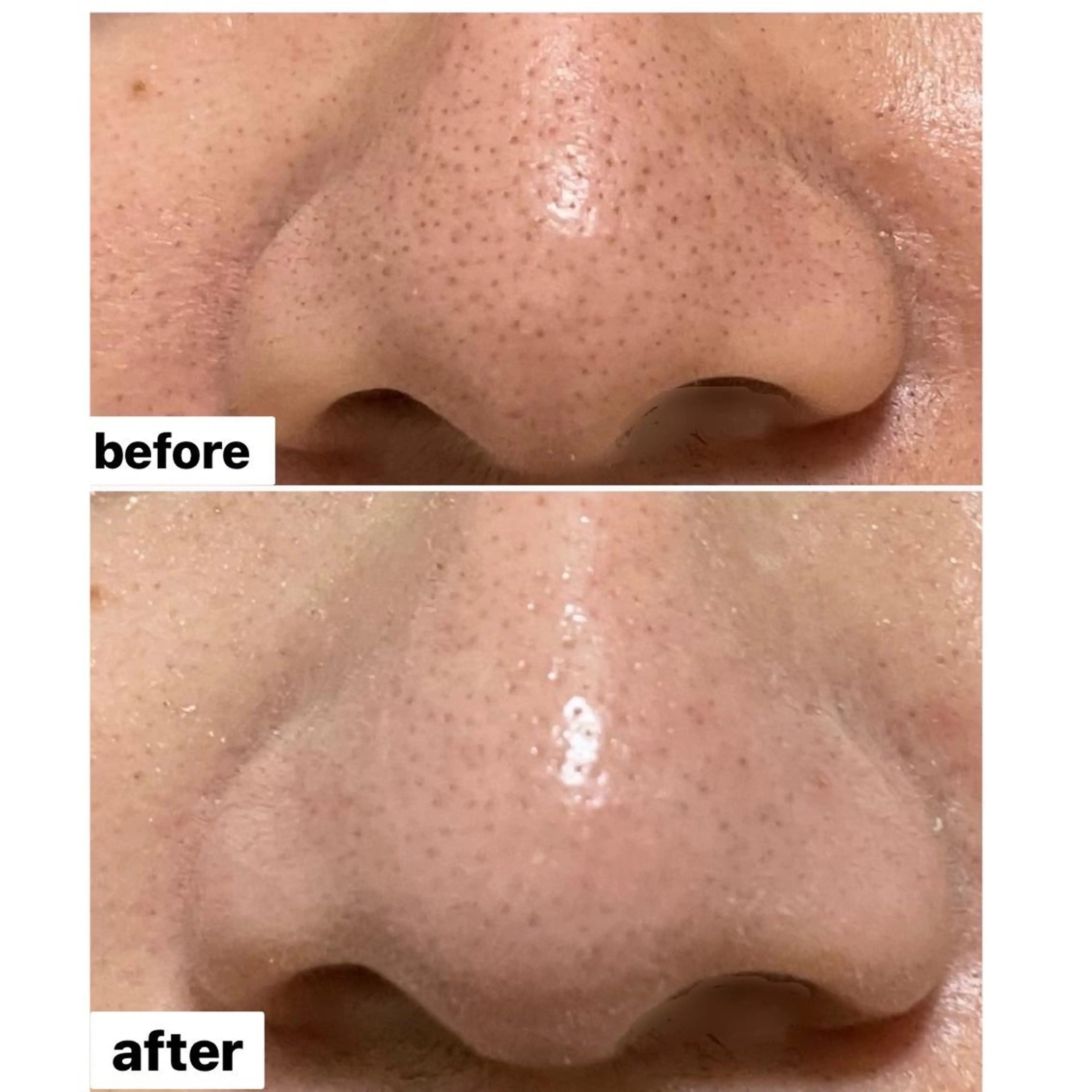 その他 アロマ•ピーリング SalonYokoのその他イメージ