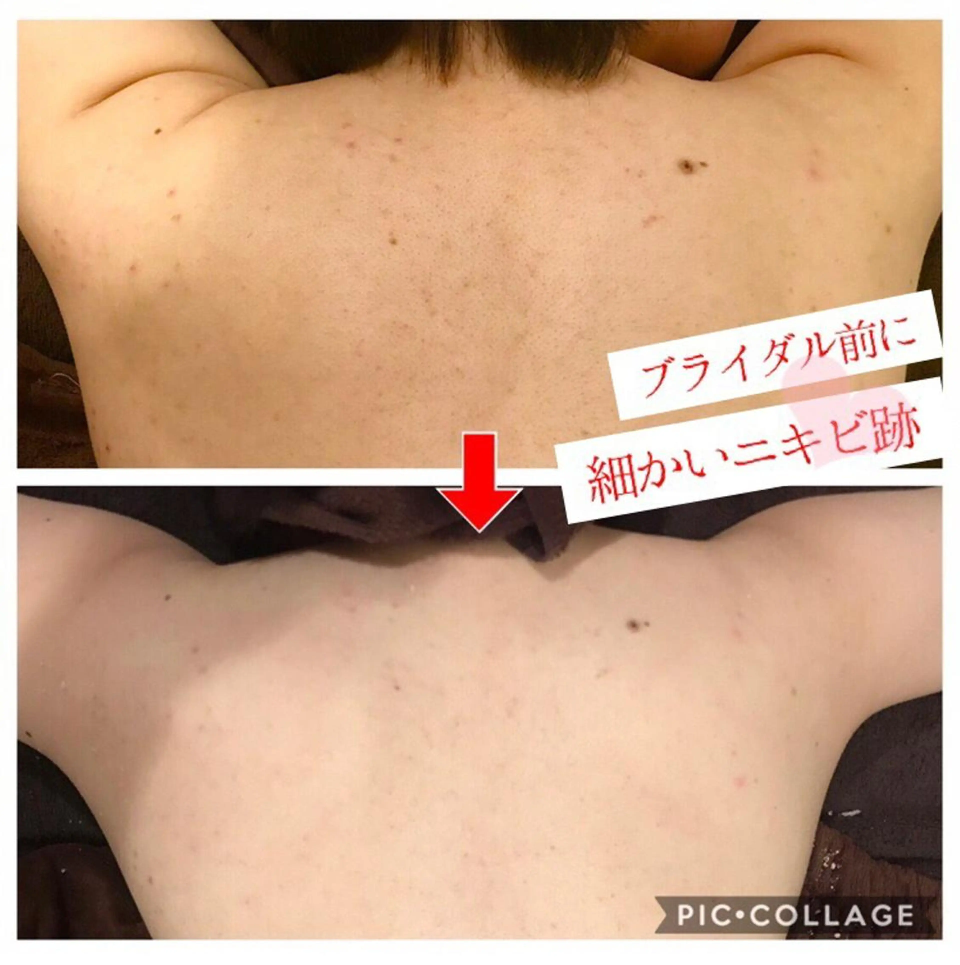 セミロング カラー パーマ ヘアアレンジ メンズ キッズ ネイル マツエク・マツパ 金の糸脱毛 産毛ケア専門のエステ・リラクイメージ