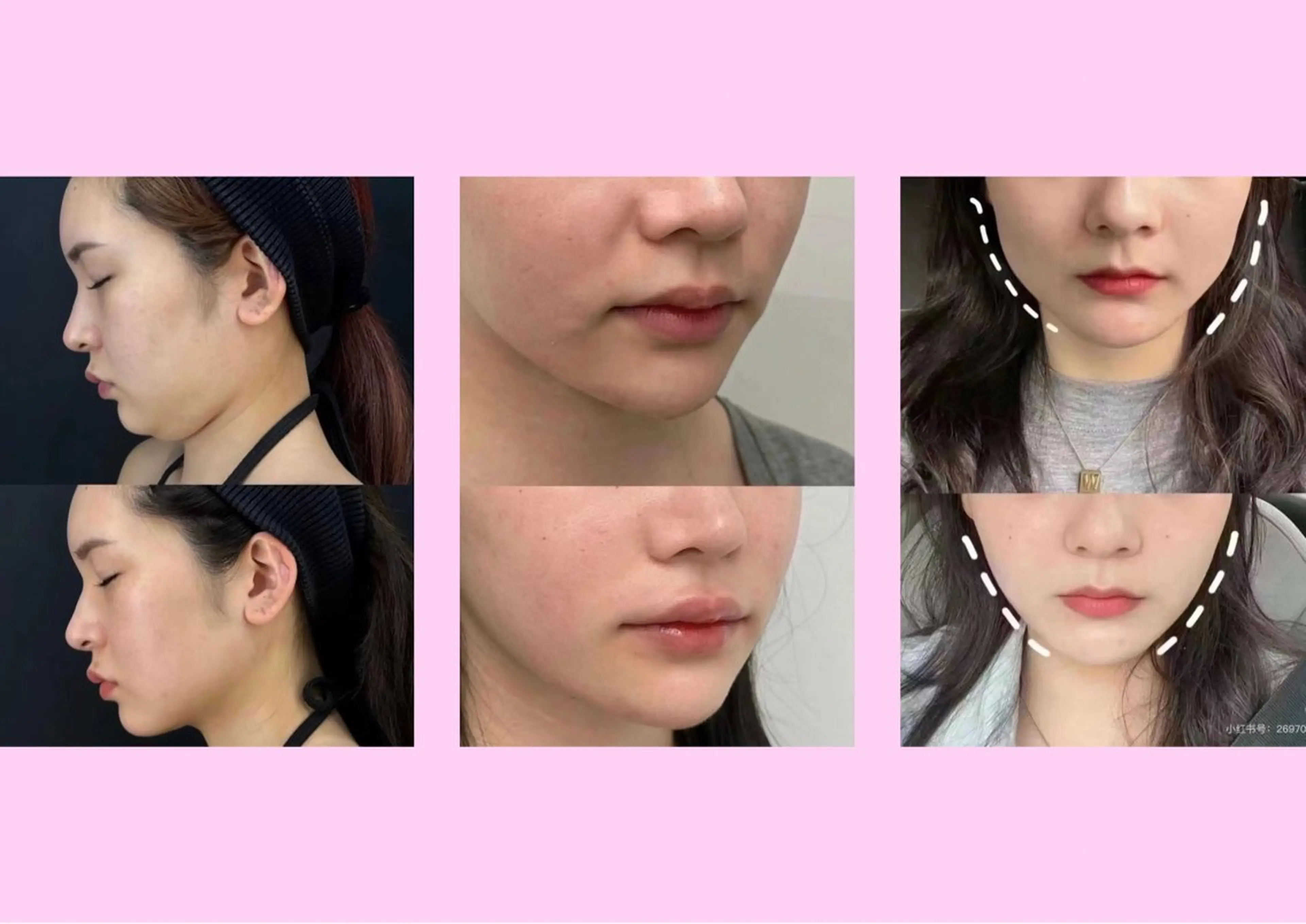 エステ リラク 愛維美水光美肌専門店所属・愛維美水光美肌専門店 メンズレディースokのエステ・リラクイメージ