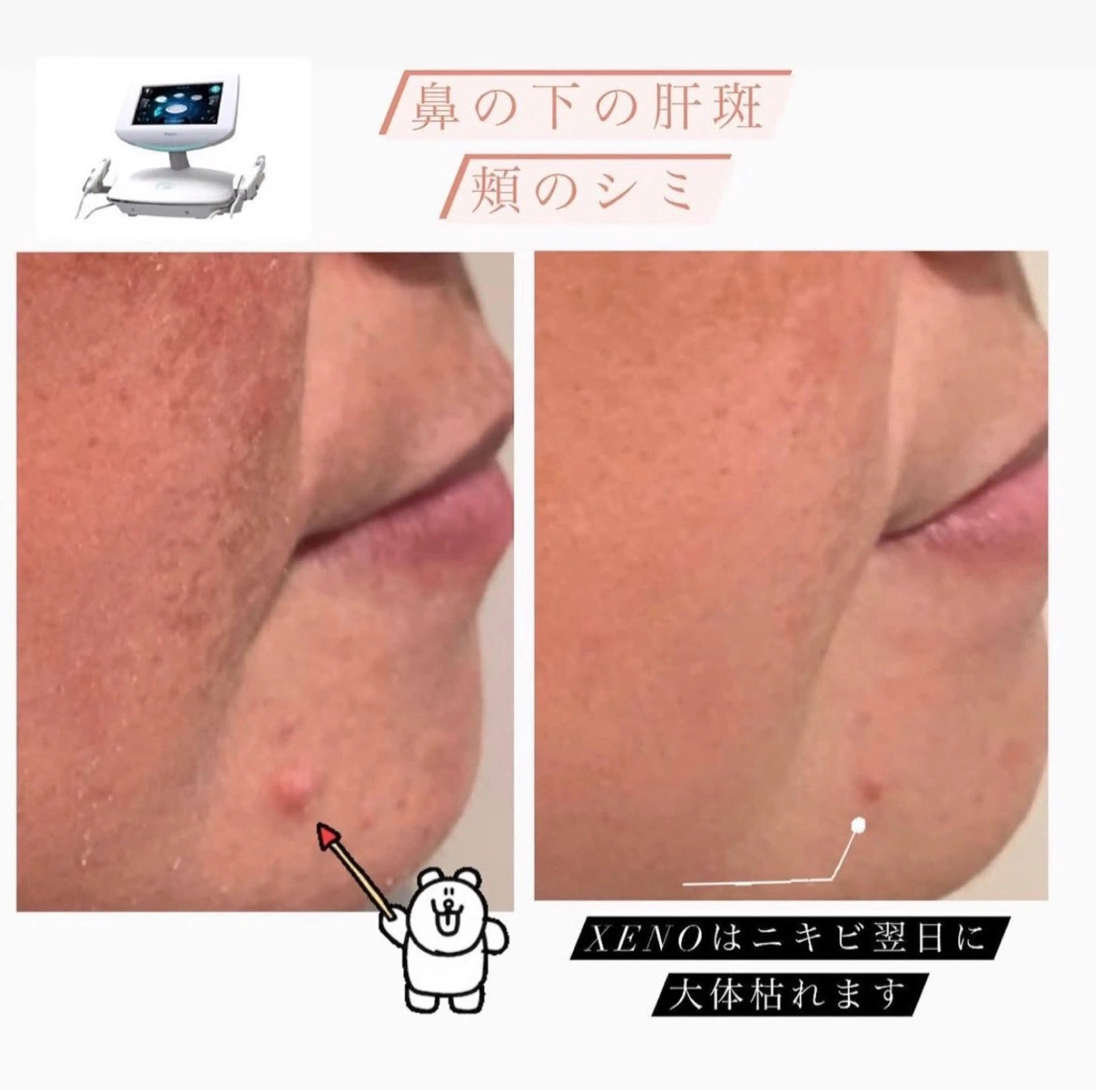 エステ Lumiere despoir所属・Lumiere despoirのエステ・リラクイメージ