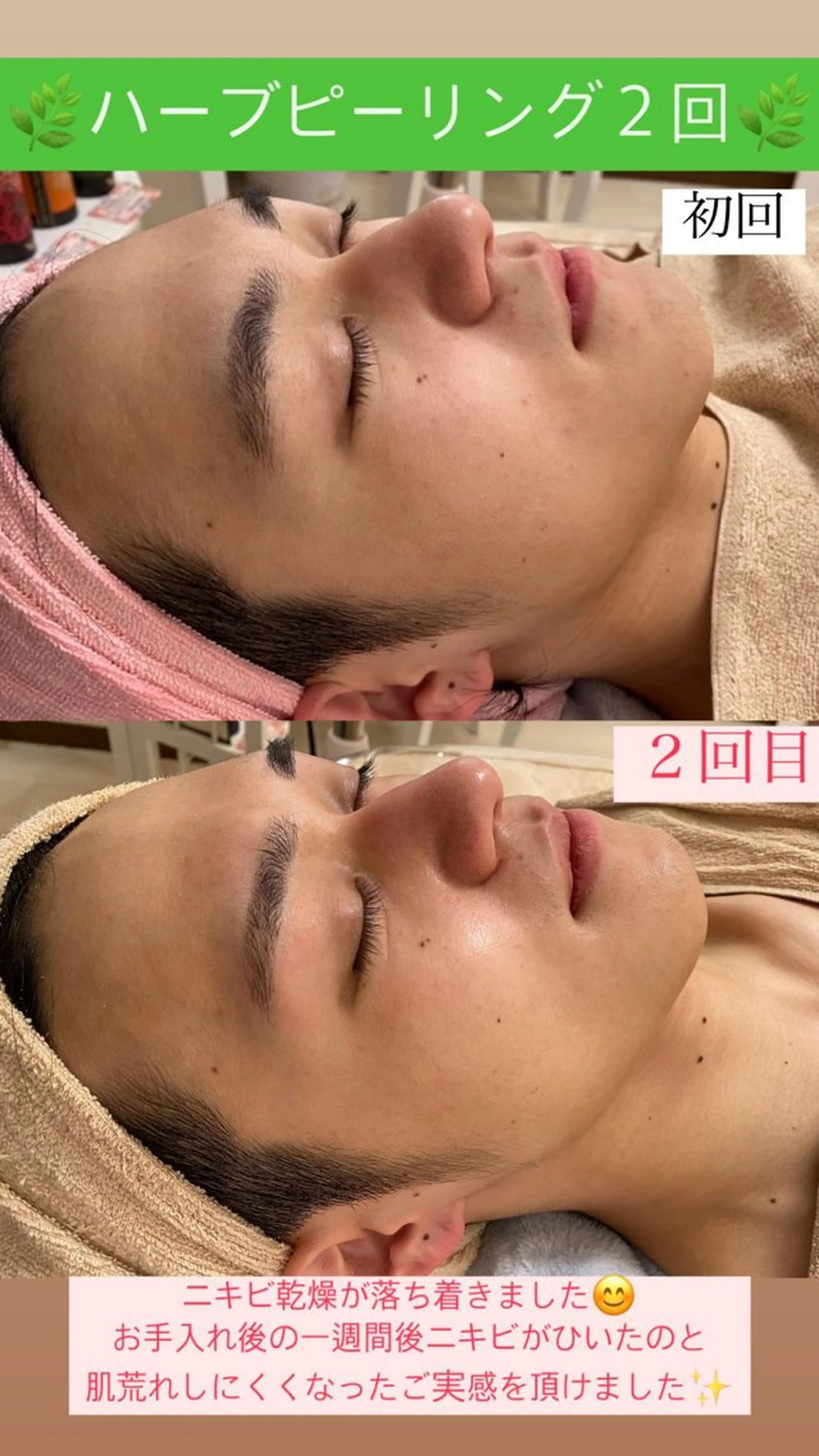 メンズ エステ Salon de Lino 御器所のエステ・リラクイメージ