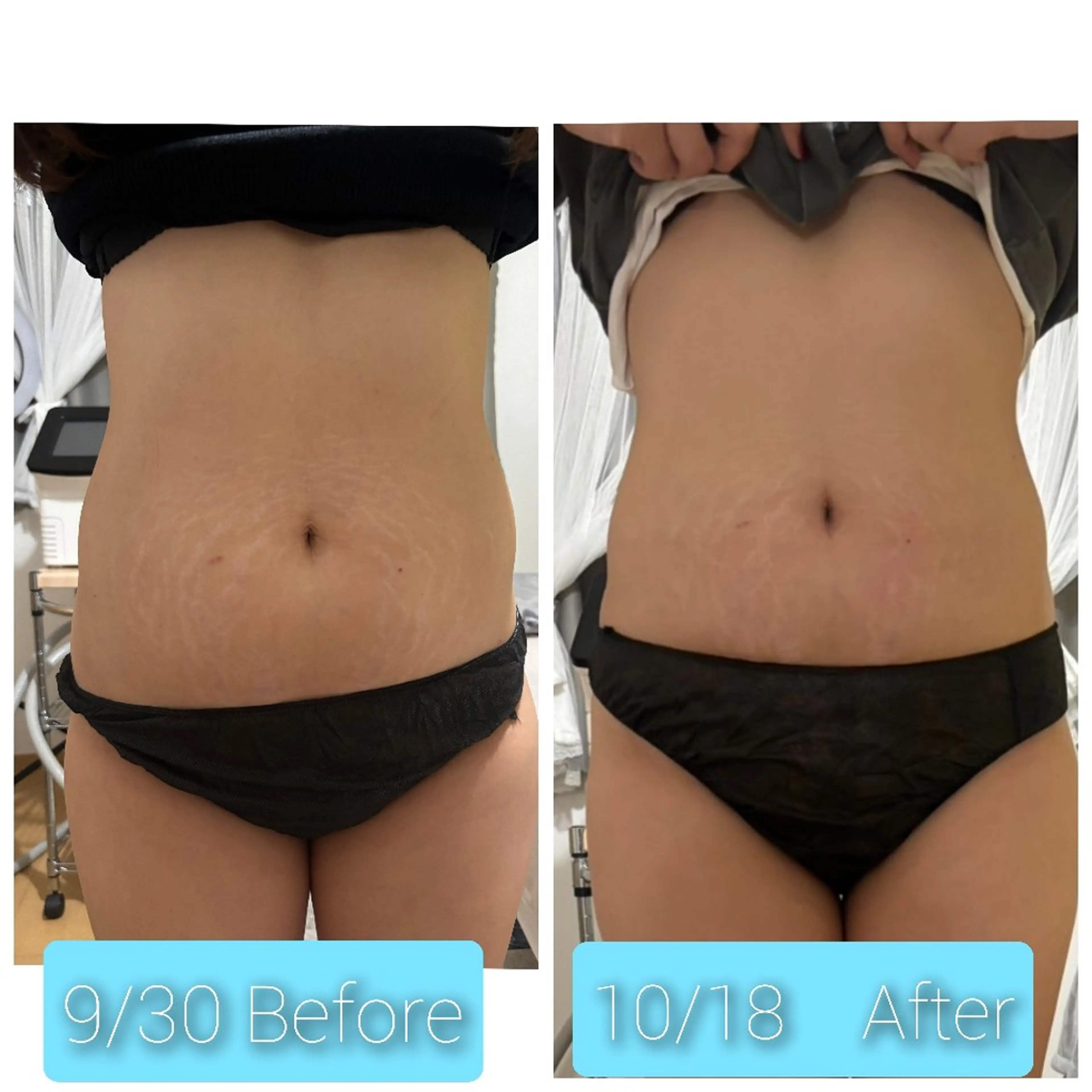 エステ Beauty Salon Luana所属・Luanaまつパ脱毛 ハーブピーリング眉毛のマツエク・マツパデザイン