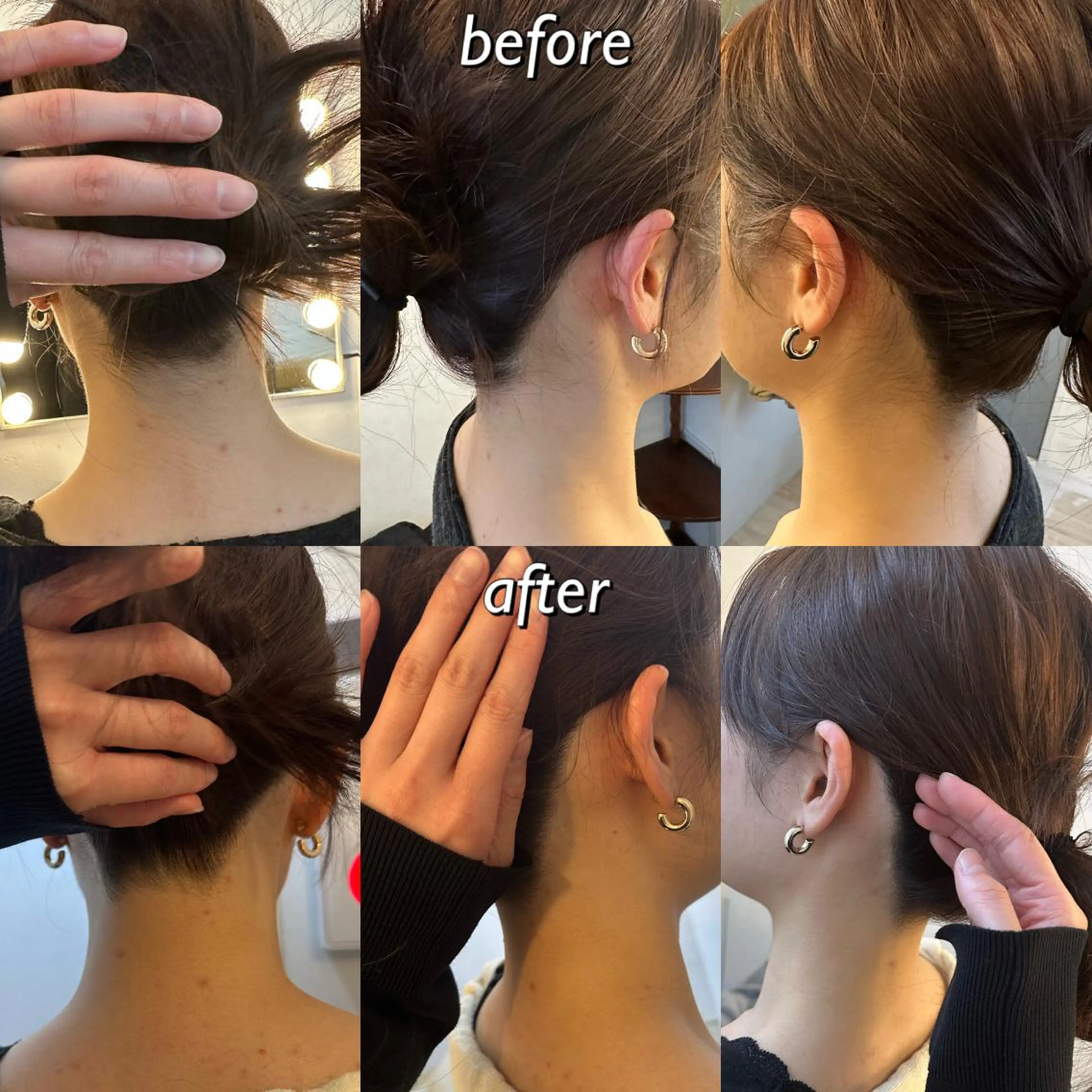 うなじ脱毛/美肌脱毛 LABELのエステ・リラクイメージ