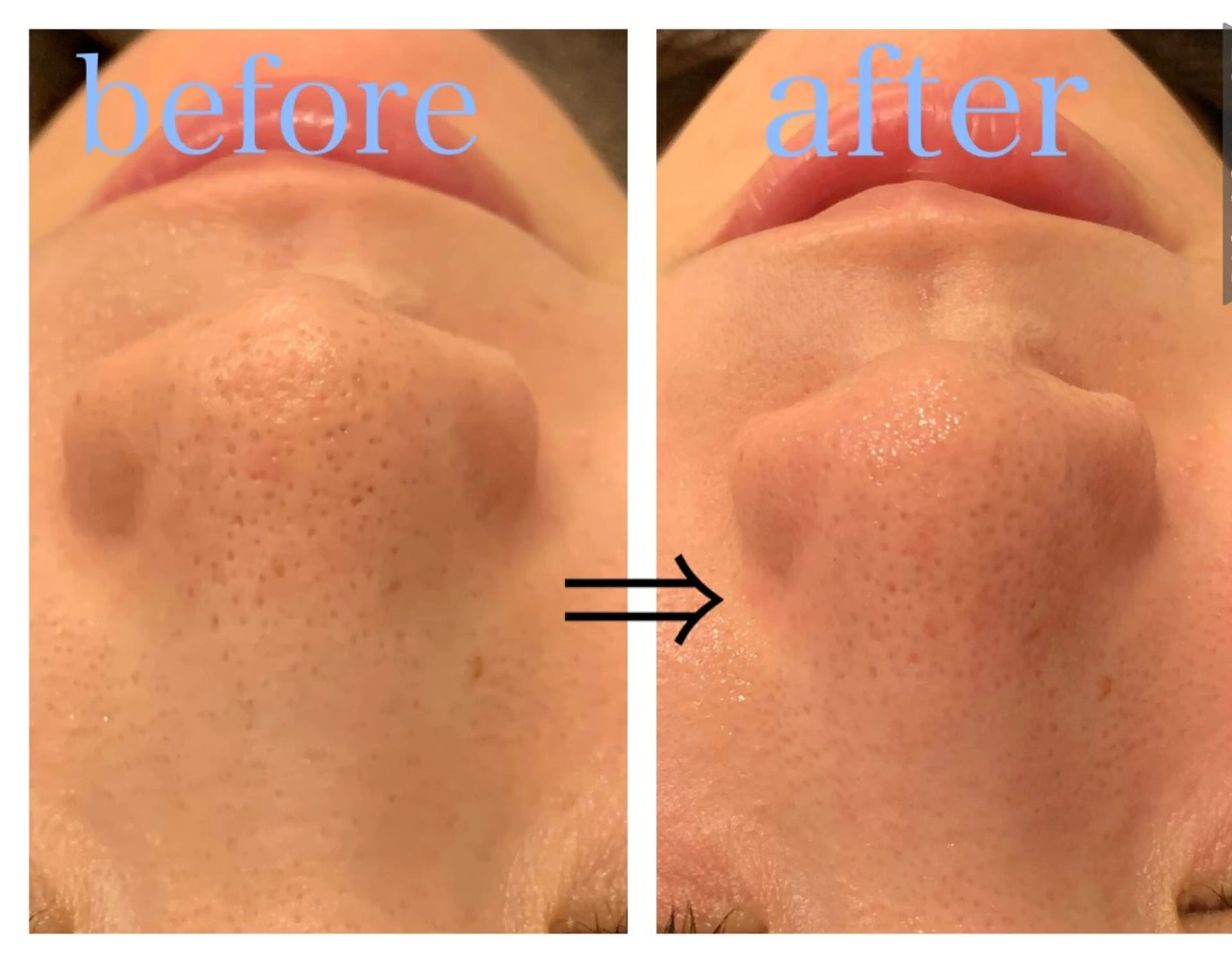 エステ リジュベ所属・Rejuve ﾘｼﾞｭﾍﾞのエステ・リラクイメージ