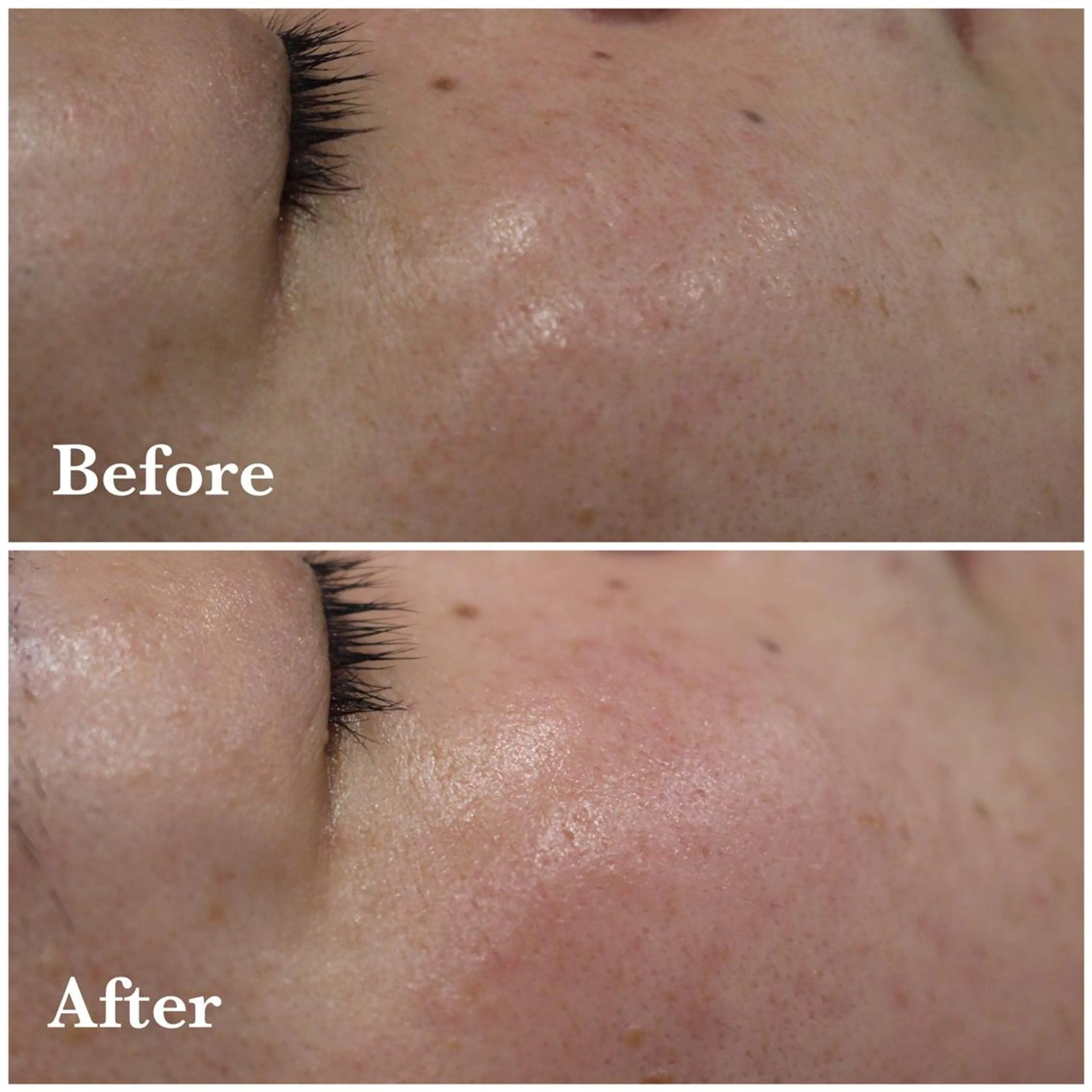 ANRIRE (アンリール)のエステ・リラクイメージ