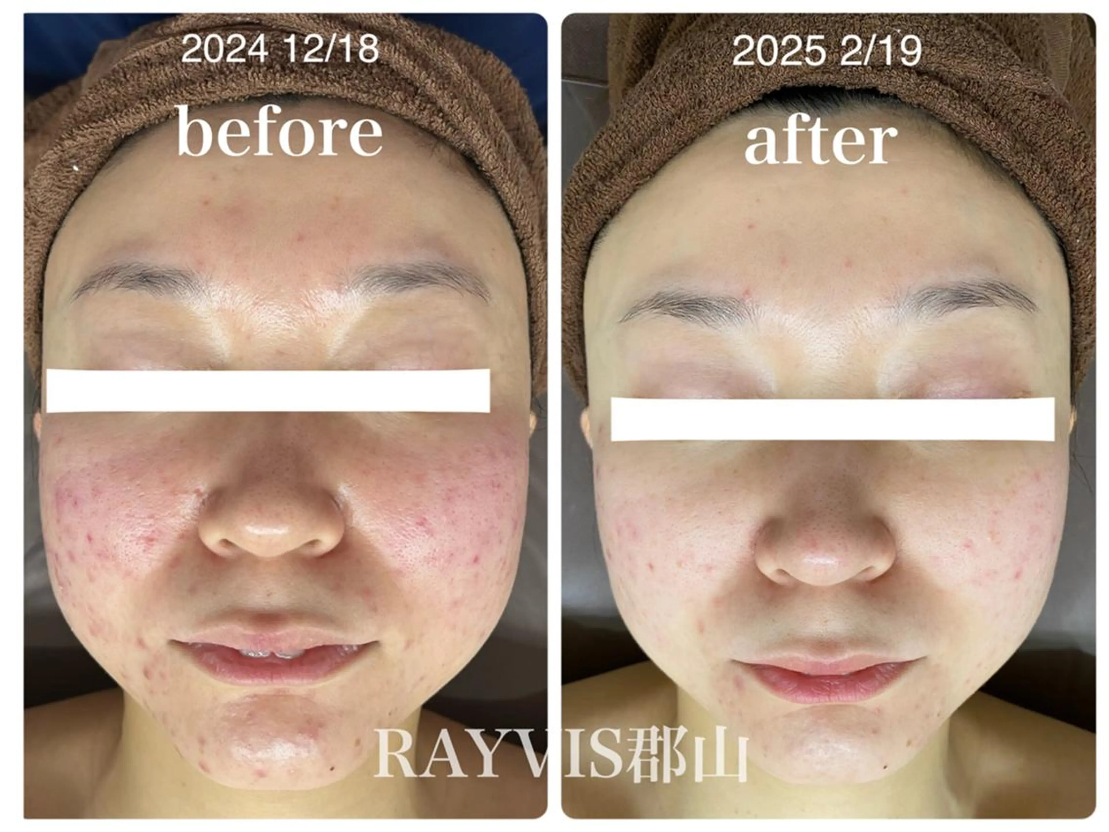 RAYVIS 郡山店のエステ・リラクイメージ