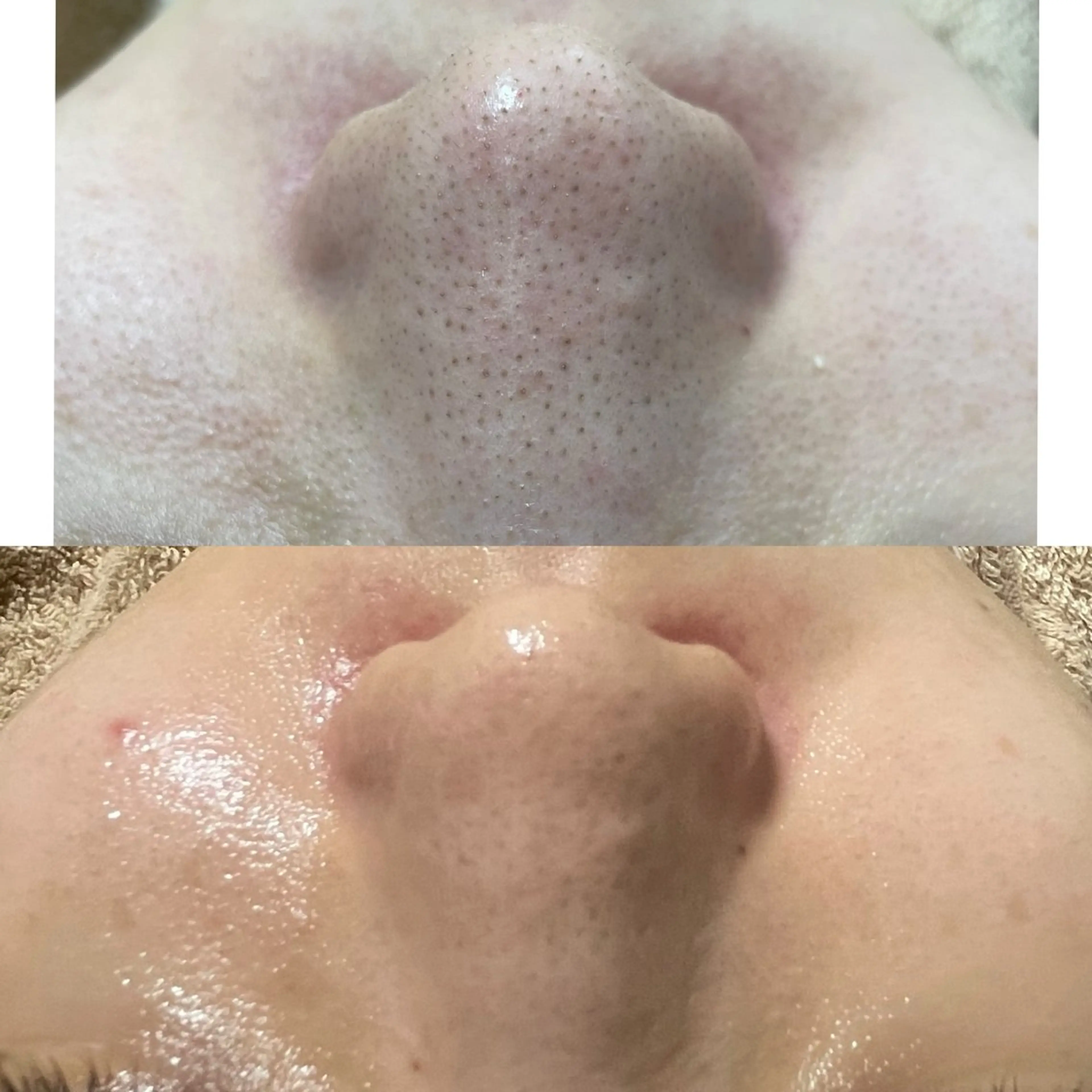 北浜/毛穴洗浄ツヤ肌 サロンaniRのエステ・リラクイメージ