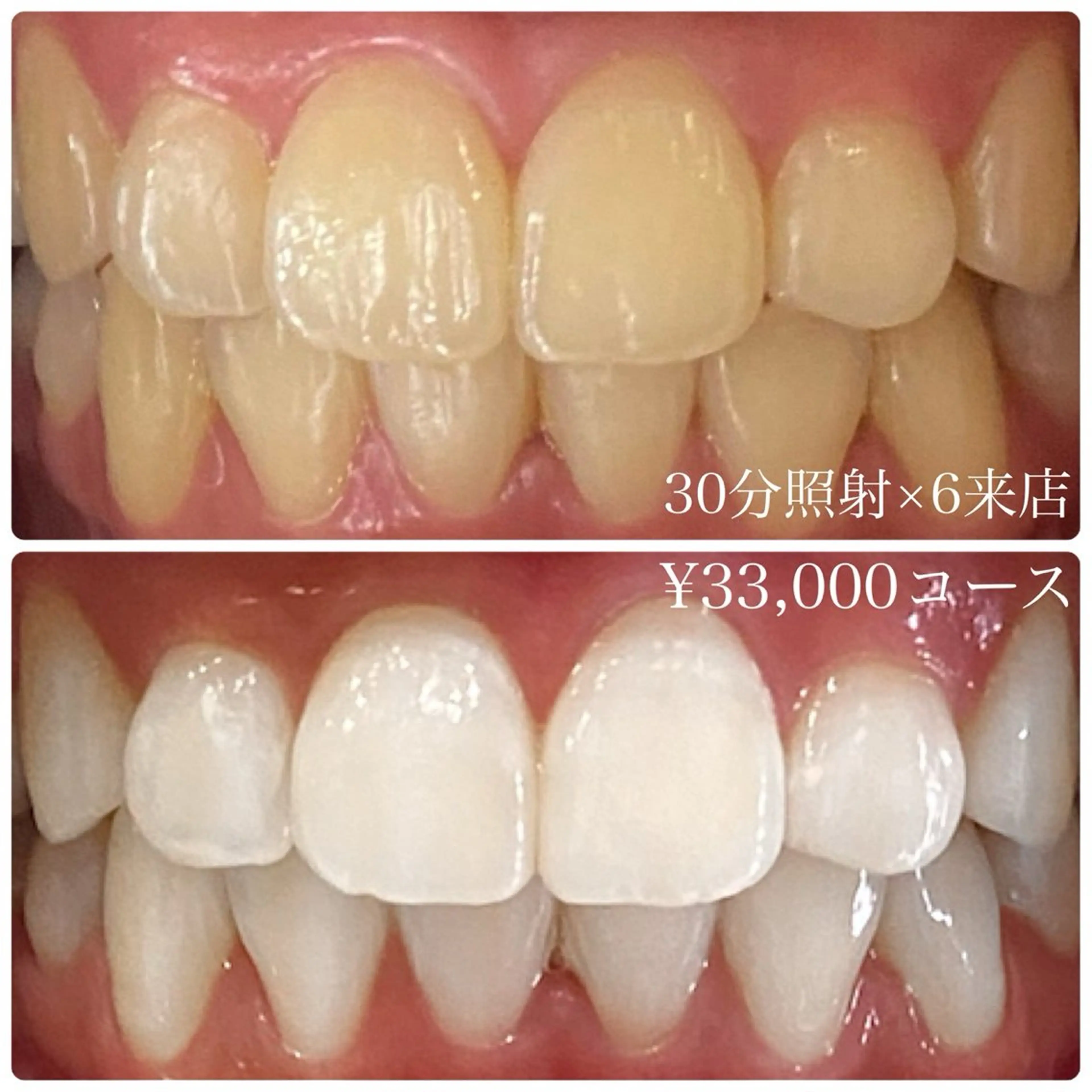 ホワイトニングルーム 横浜店のその他イメージ