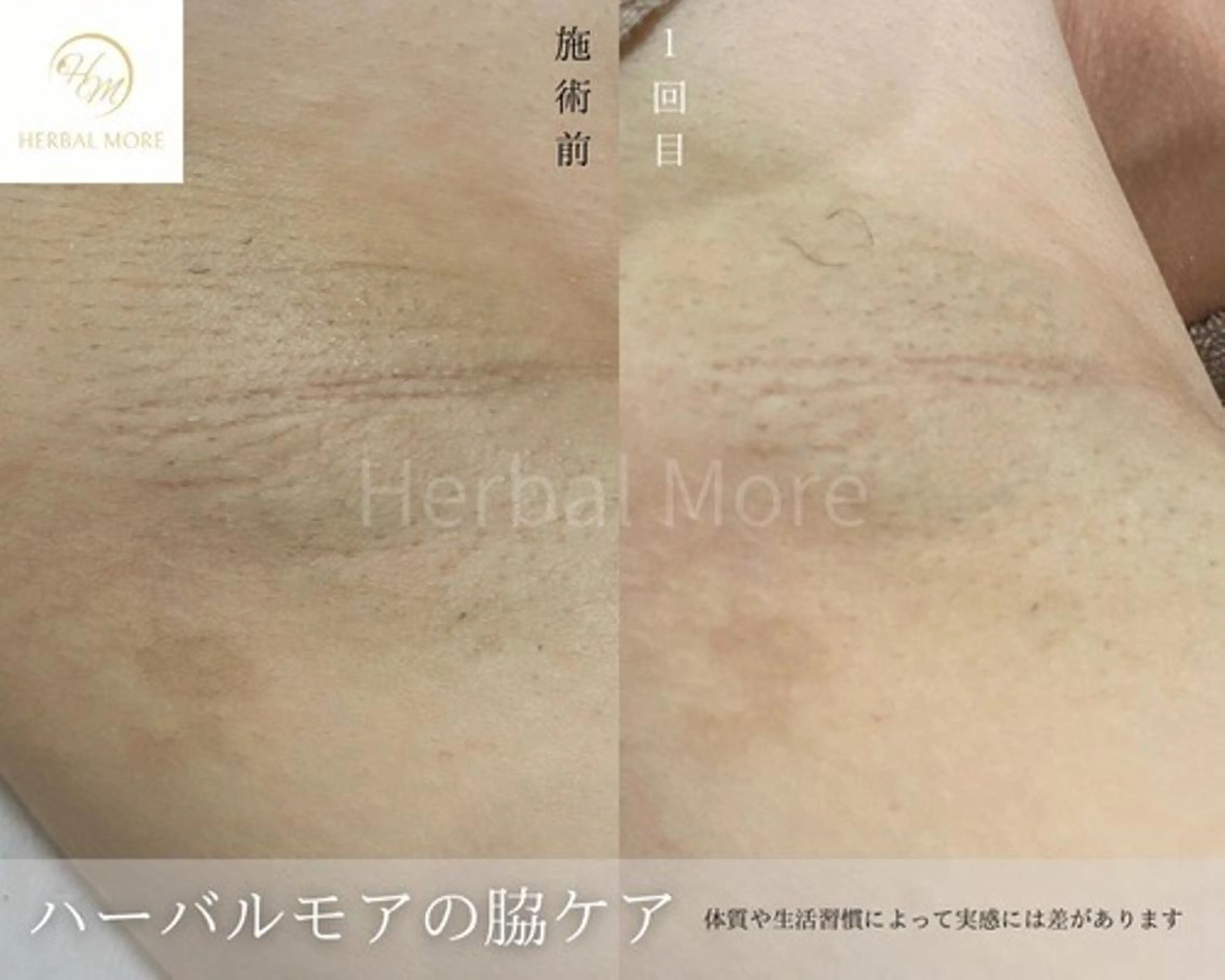 脱毛・眉毛・フェイス サロンN久留米店の眉毛・アイブロウイメージ