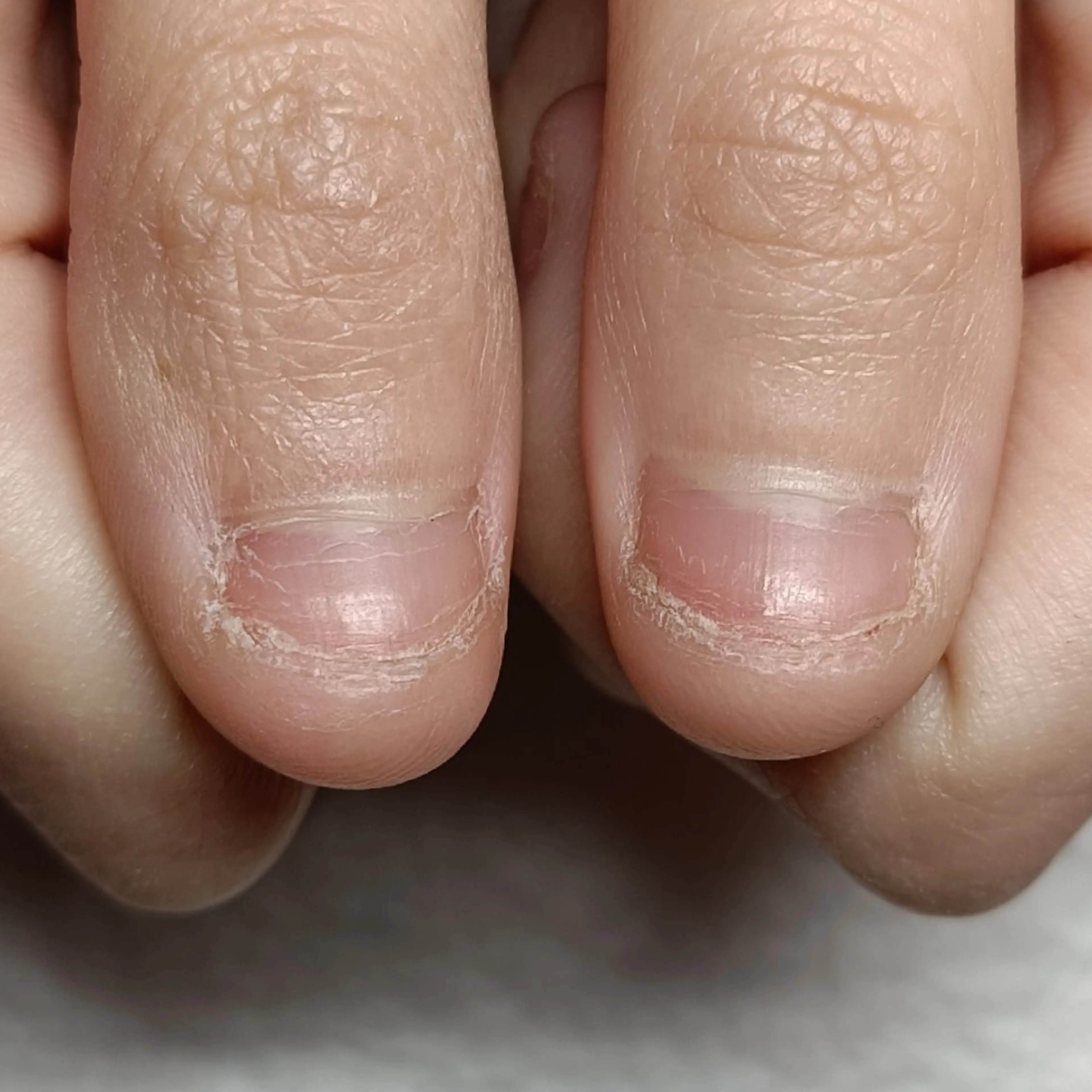 ネイル 長さ出し ハンドネイル ハンドケア 深爪矯正/爪育成ケア manie nailのネイルデザイン