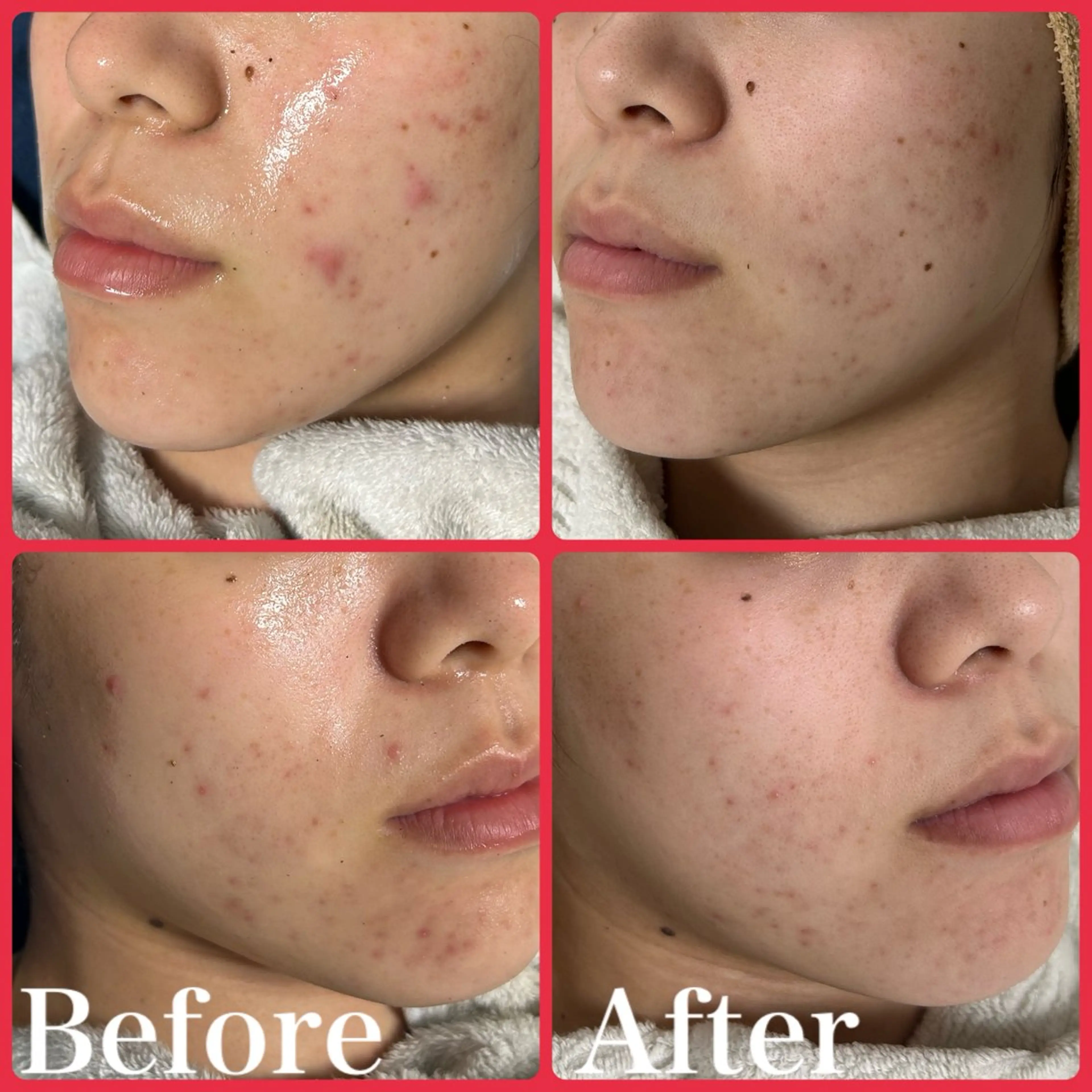 skin make salon -Olu's-所属・毛穴・肌質改善サロン ✨Tomaのその他イメージ